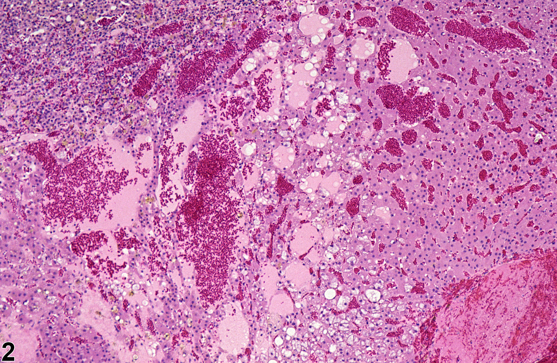 Image of degeneration, cystic in the adrenal gland cortex from a female Sprague-Dawley rat in a chronic study