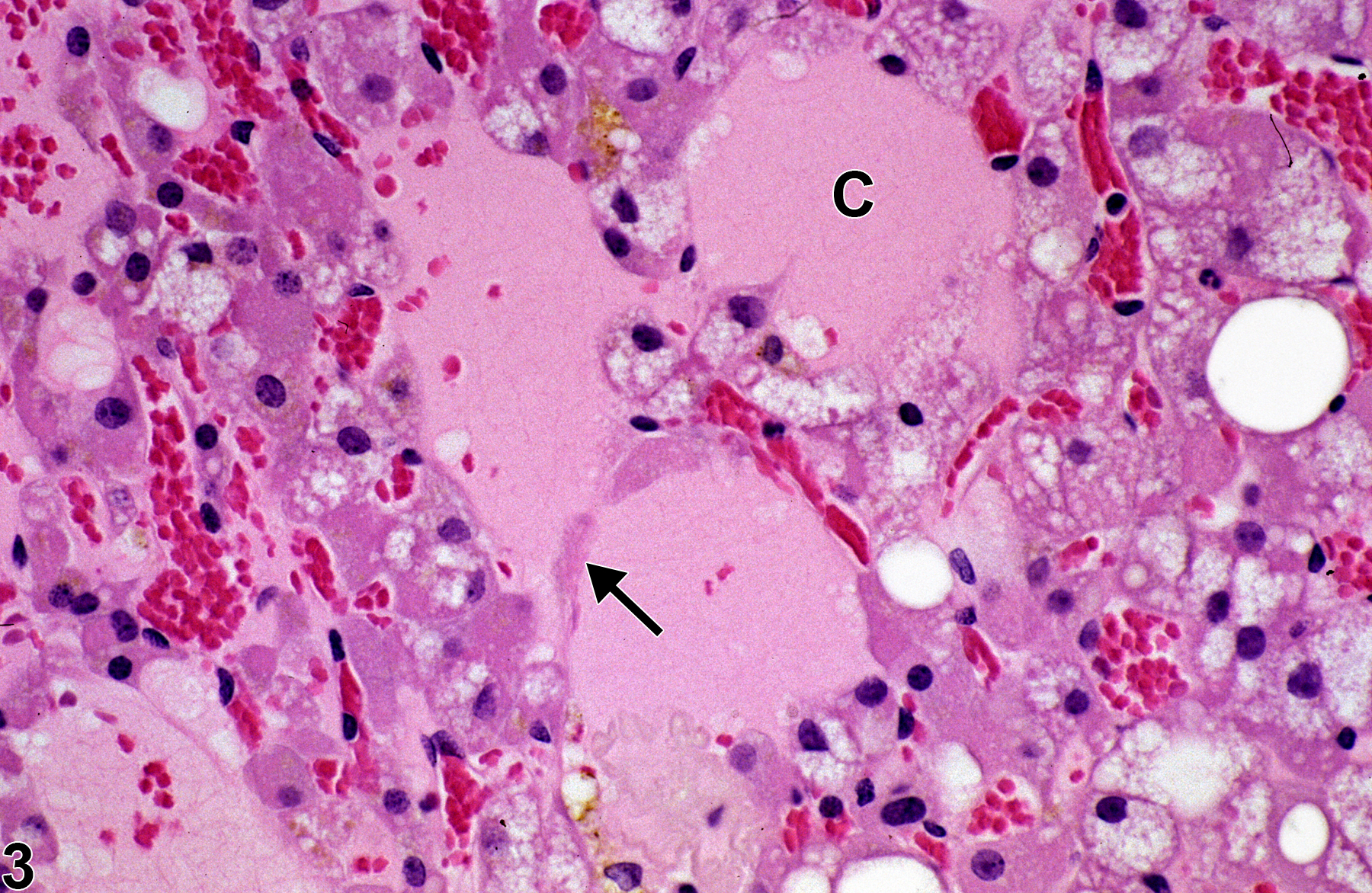Image of degeneration, cystic in the adrenal gland cortex from a female Sprague-Dawley rat in a chronic study
