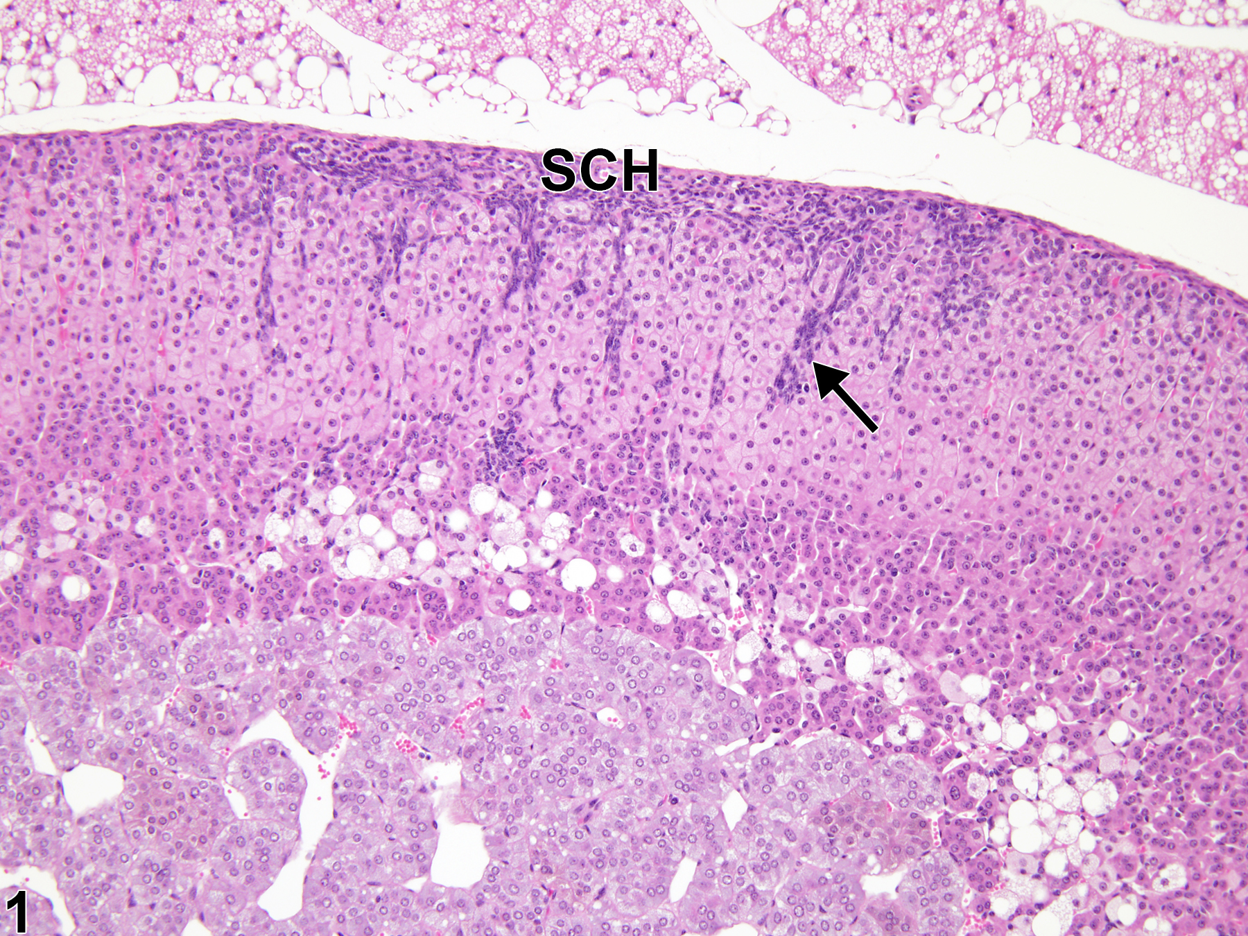 Image of hyperplasia, subcapsular in the adrenal gland cortex from a female B6C3F1/N mouse in a subchronic study
