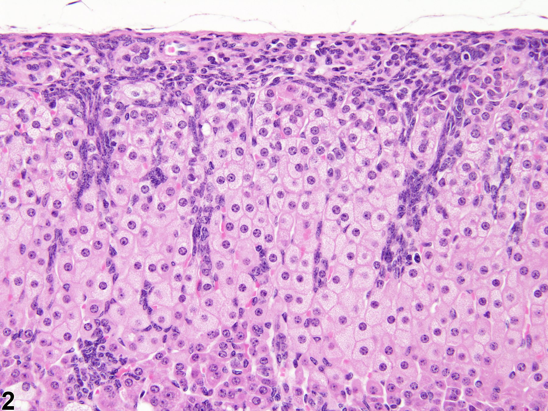 Image of hyperplasia, subcapsular in the adrenal gland cortex from a female B6C3F1/N mouse in a subchronic study