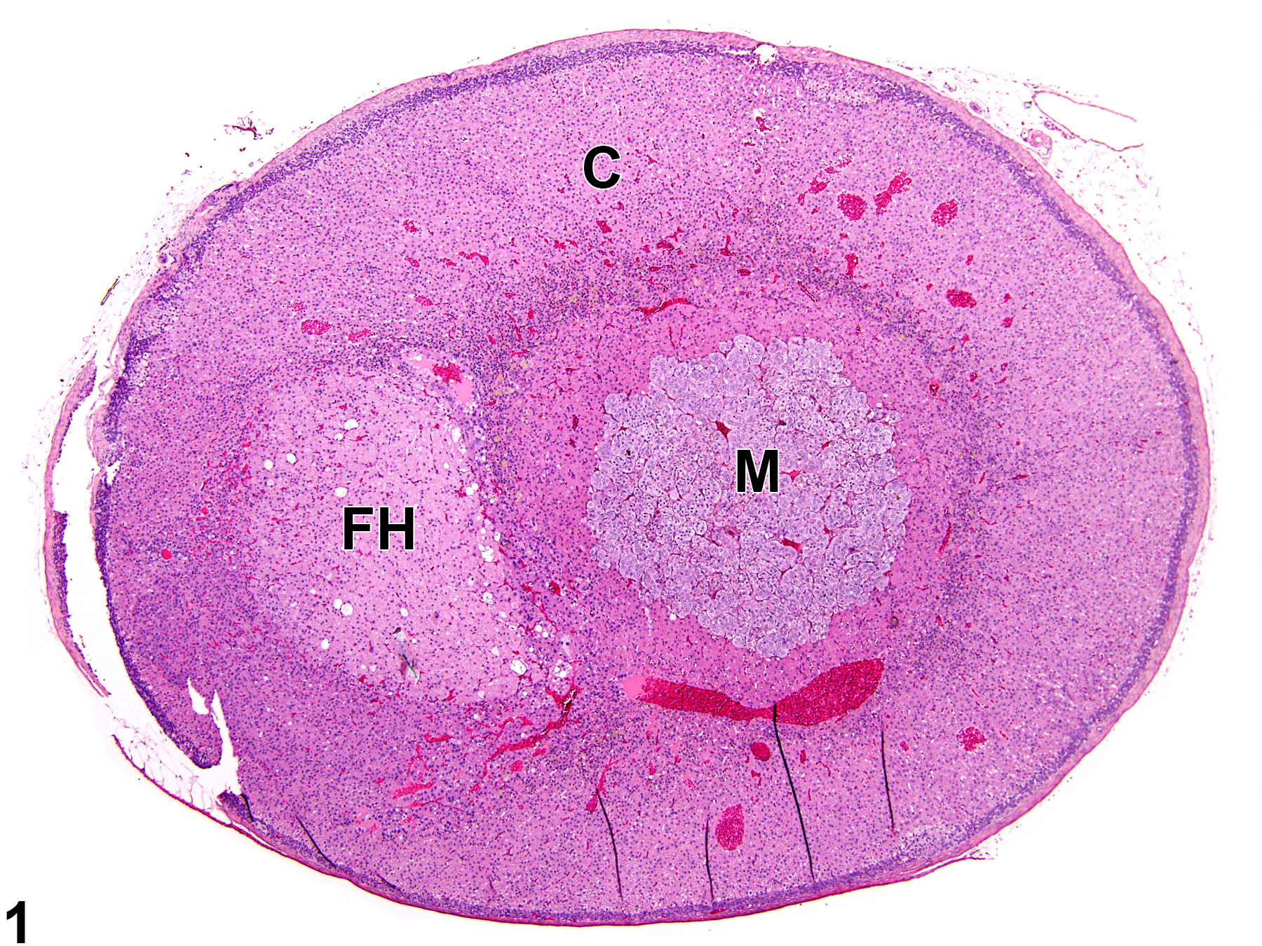 Image of hypertrophy in the adrenal gland cortex from a female Sprague-Dawley rat in a chronic study