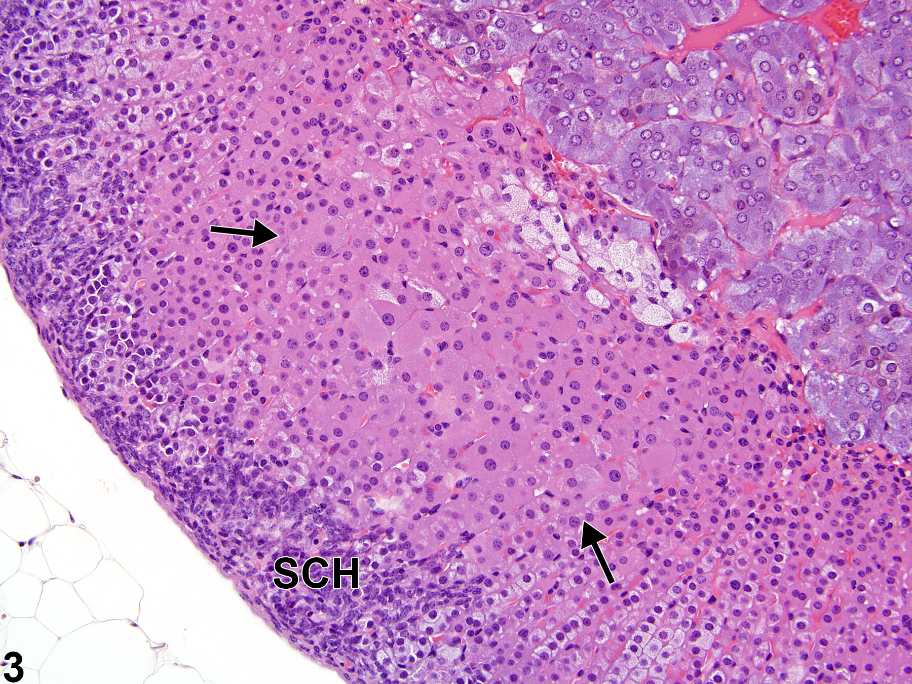 Image of hypertrophy in the adrenal gland cortex from a male B6C3F1/N mouse in a chronic study