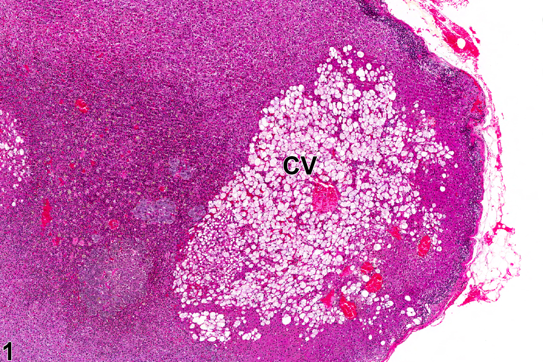Image of vacuolization, cytoplasmic in the adrenal gland cortex from a female F344/N rat in a chronic study