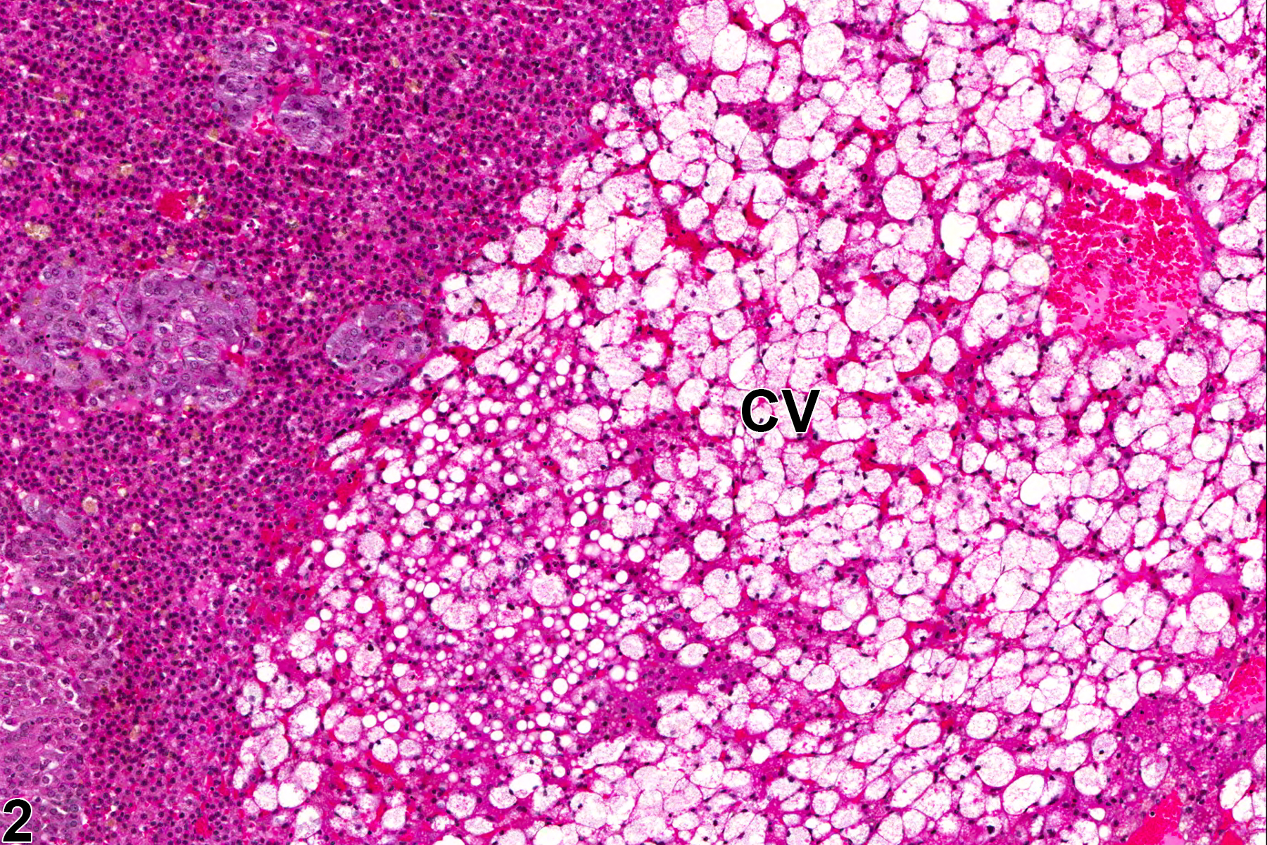Image of vacuolization, cytoplasmic in the adrenal gland cortex from a female F344/N rat in a chronic study
