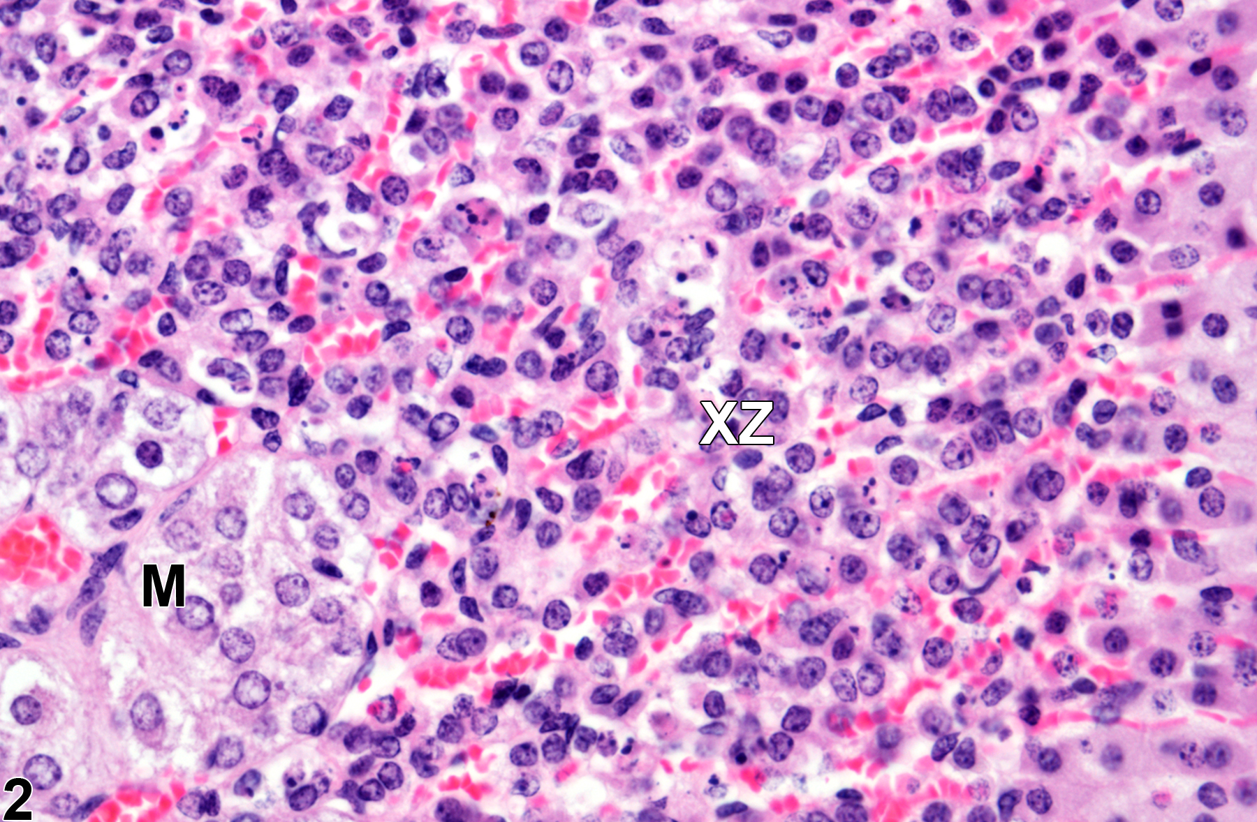 Image of atrophy in the adrenal gland cortex x-zone from a female B6C3F1/N mouse in a subchronic study