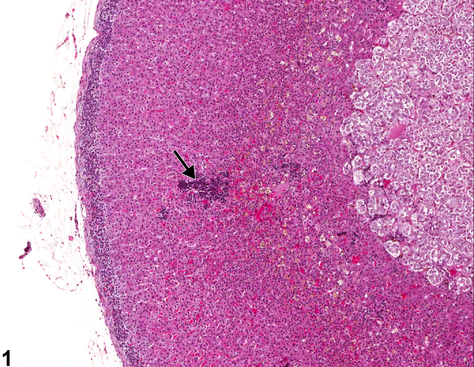 Image of extramedullary hematopoiesis in the adrenal gland from a female F344/N rat in a chronic study