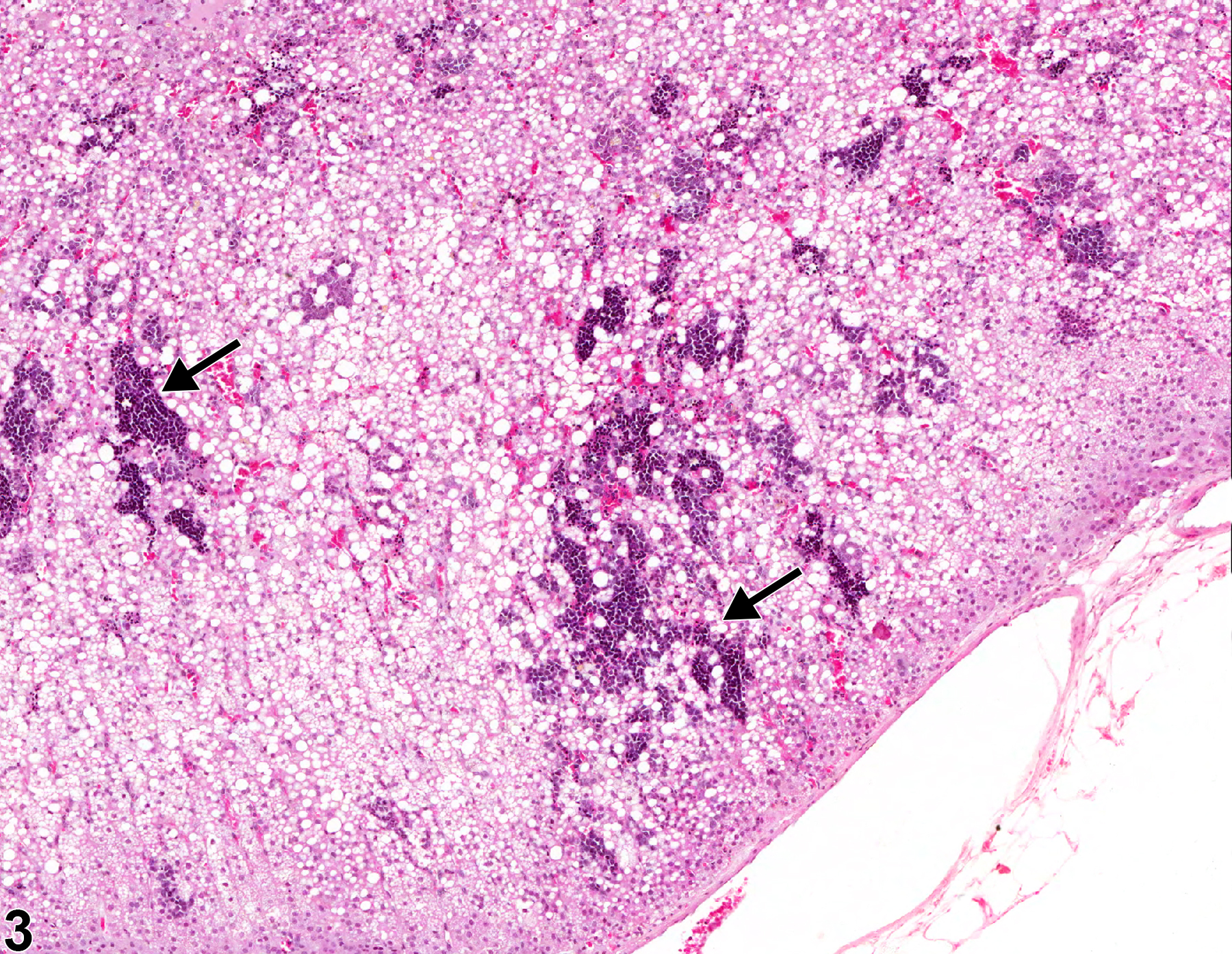Image of extramedullary hematopoiesis in the adrenal gland from a male F344/N rat in a chronic study