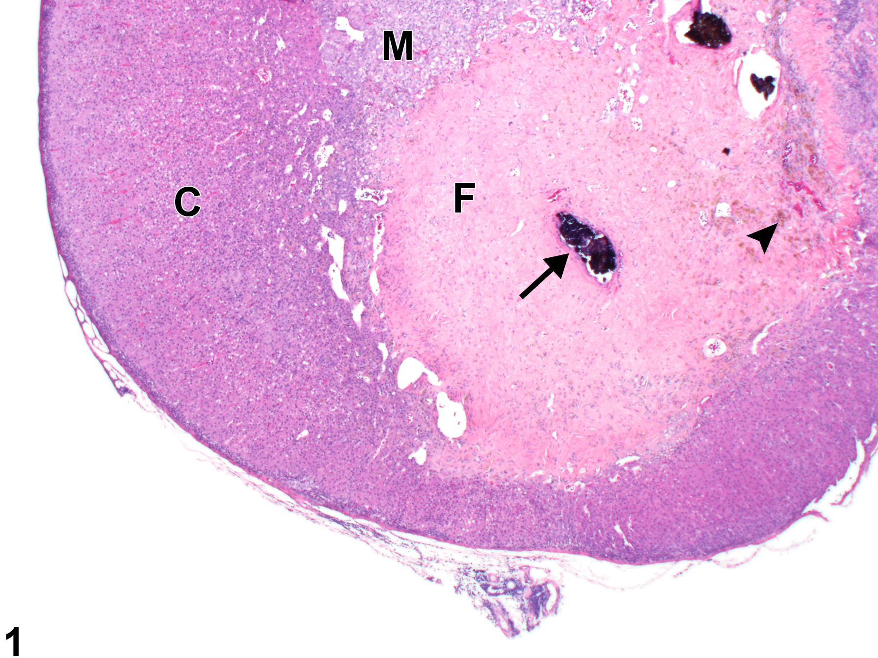 Image of fibrosis in the adrenal gland from a female F344/N rat in a chronic study