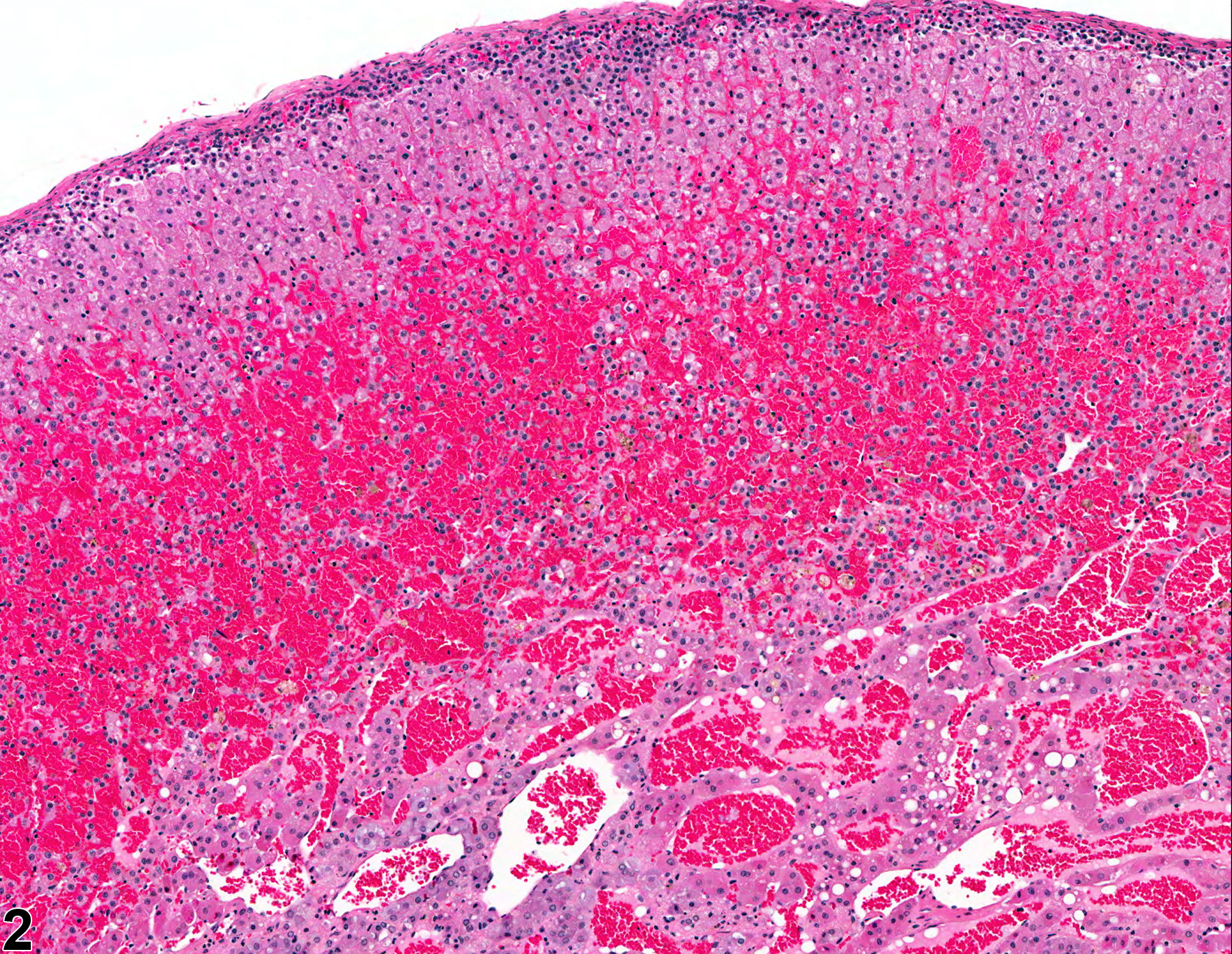 Image of hemorrhage in the adrenal gland from a female F344/N rat in a chronic study