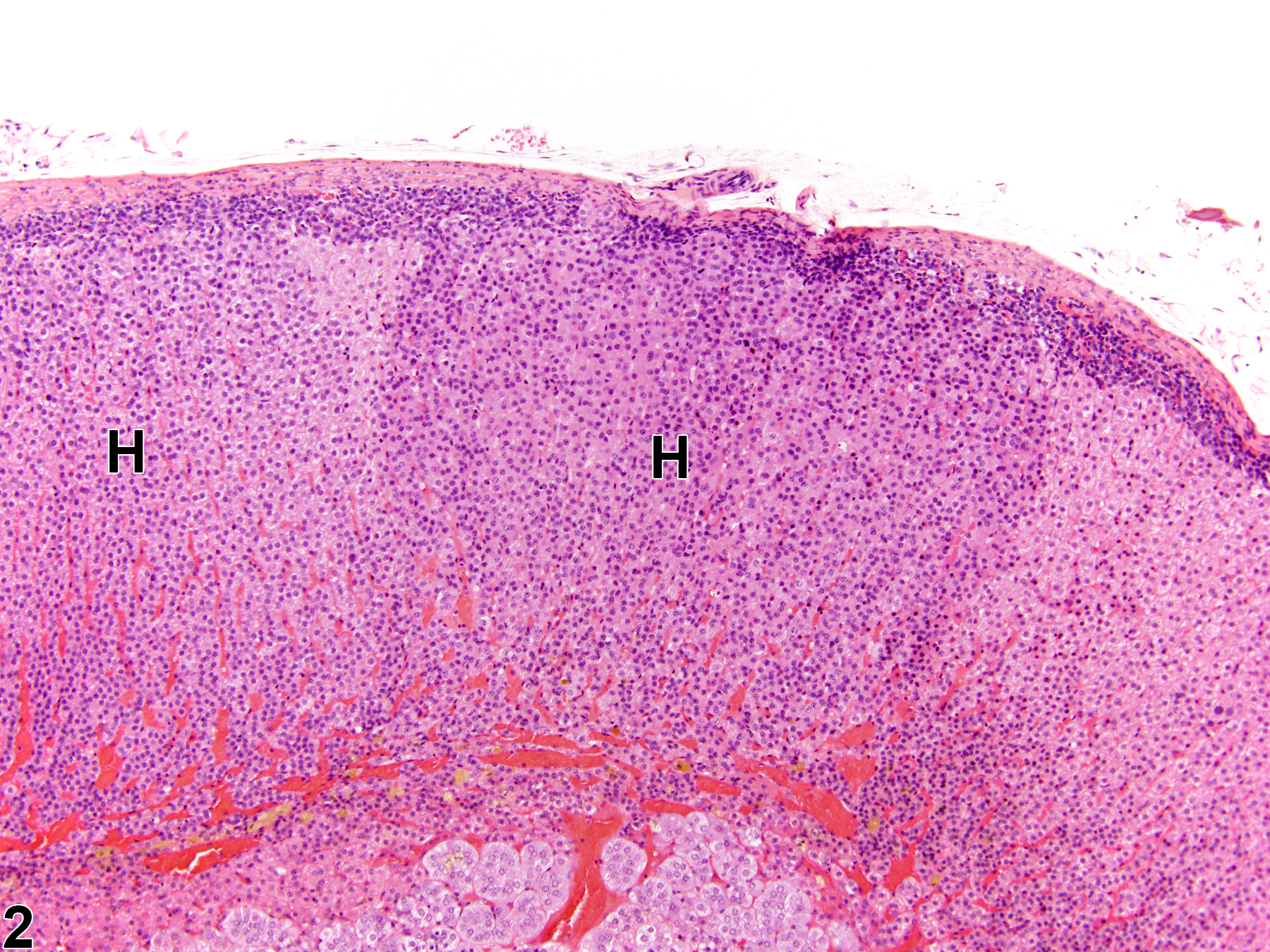 Image of hyperplasia in the adrenal gland cortex from a male Sprague-Dawley rat in a chronic study
