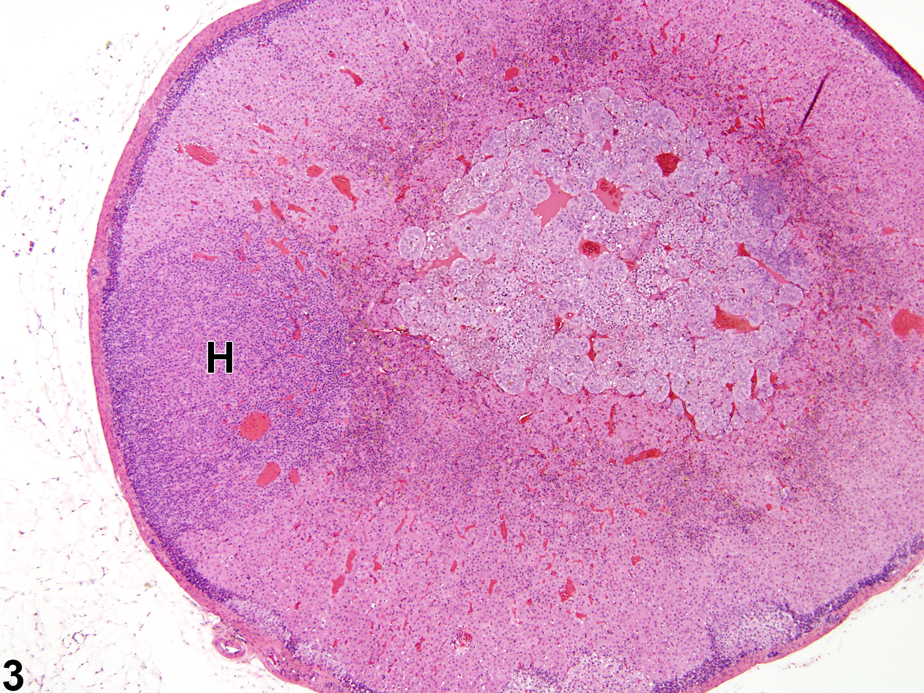 Image of hyperplasia in the adrenal gland cortex from a female Sprague-Dawley rat in a chronic study