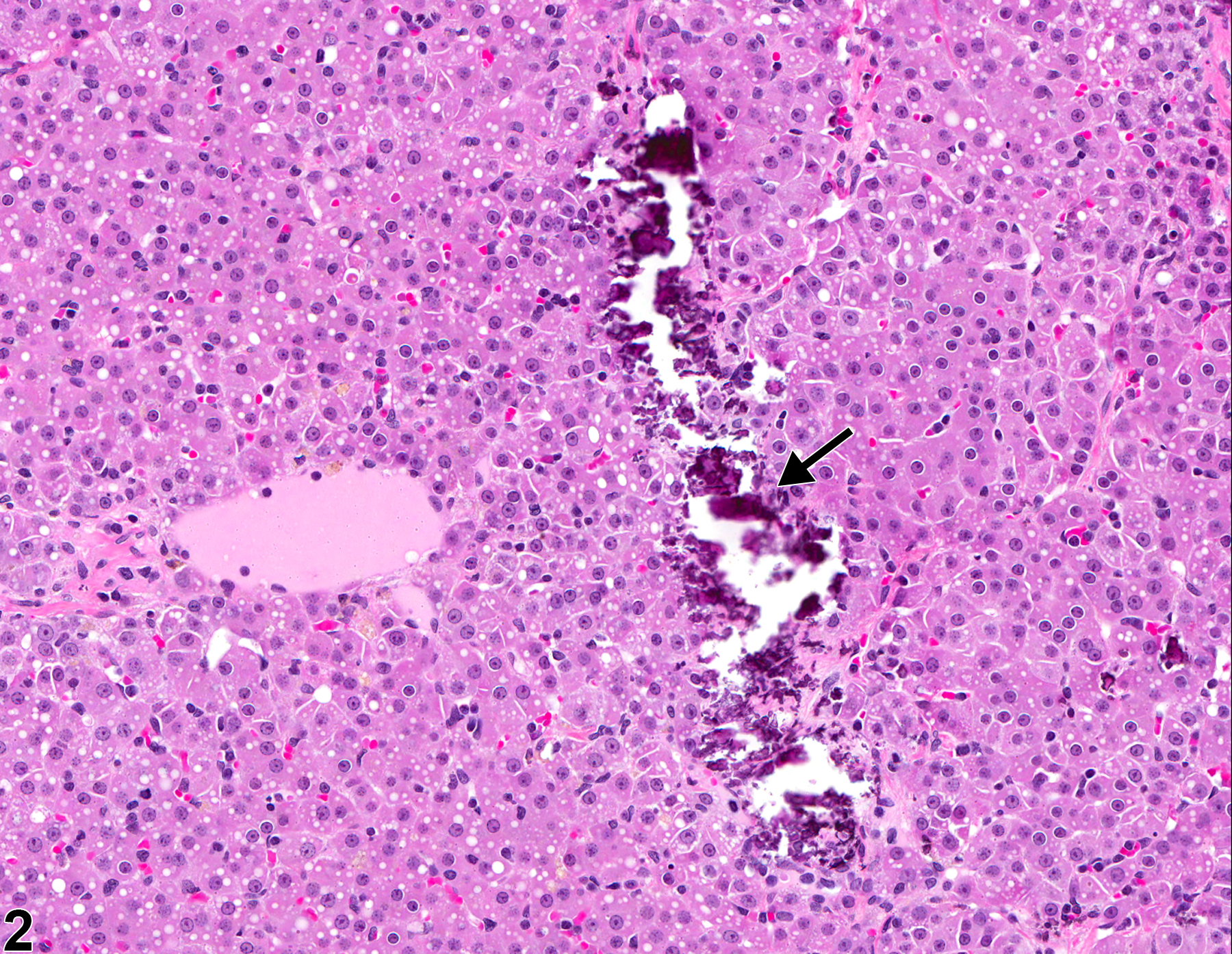 Image of mineralization in the adrenal gland from a male F344/N rat in a chronic study