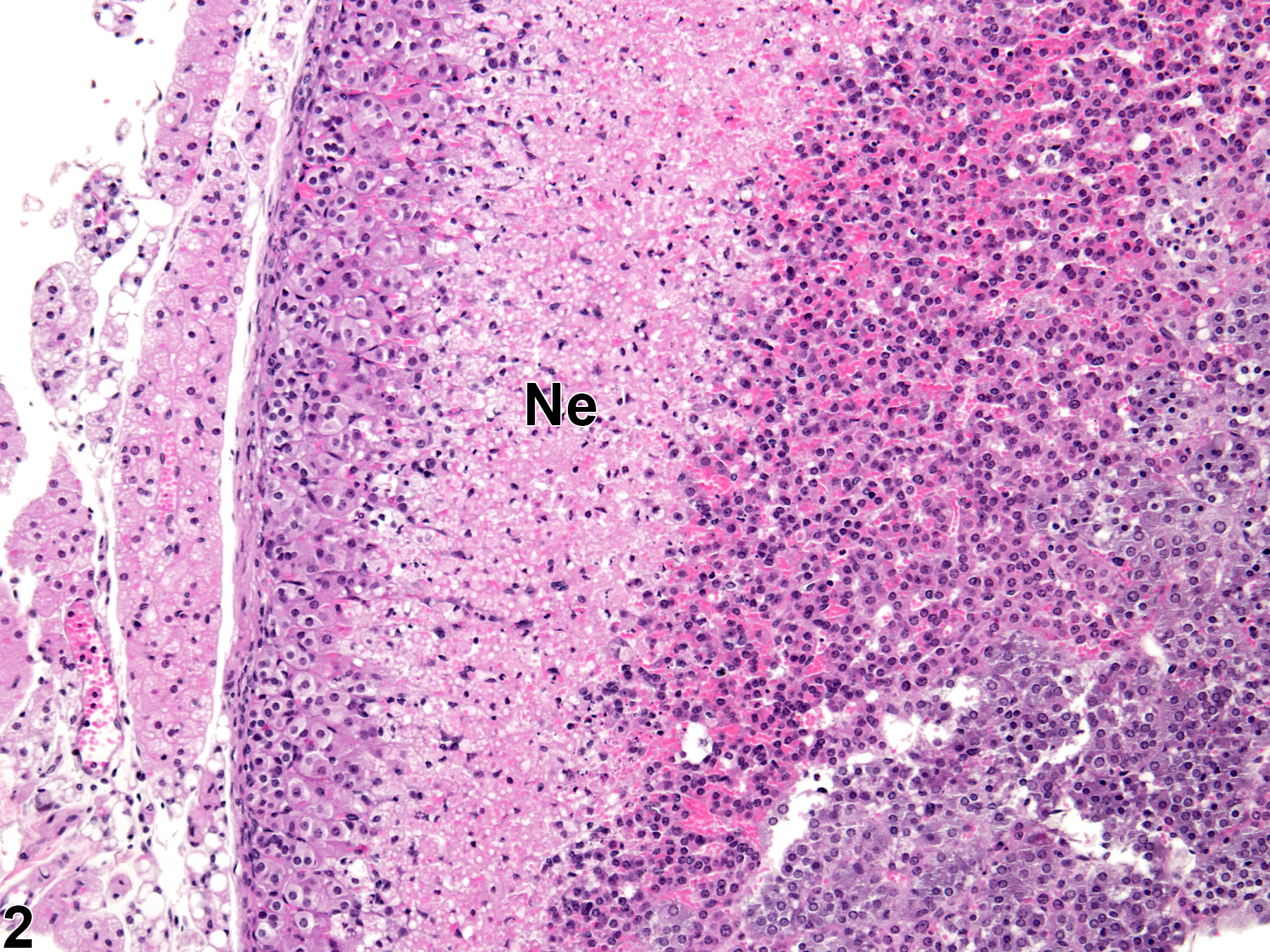 Image of necrosis in the adrenal gland cortex from a female B6C3F1/N mouse in a subchronic study