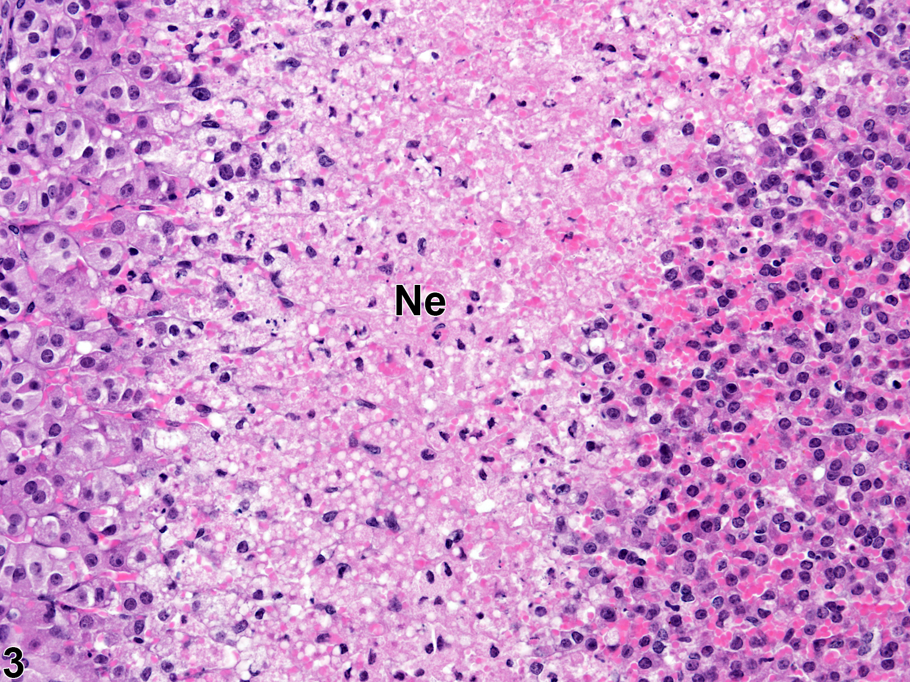 Image of necrosis in the adrenal gland cortex from a female B6C3F1/N mouse in a subchronic study