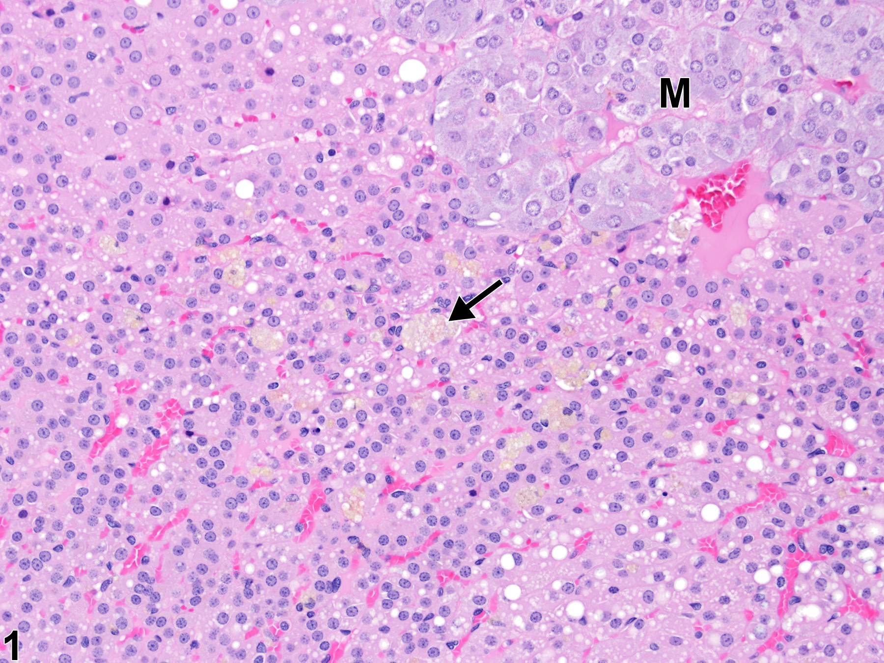 Image of pigment in the adrenal gland cortex from a male F344/N rat in a chronic study