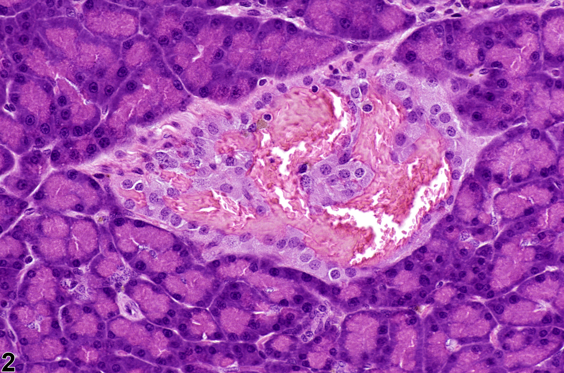 Image of angiectasis in the pancreatic islet from a male F344/N rat in a chronic study