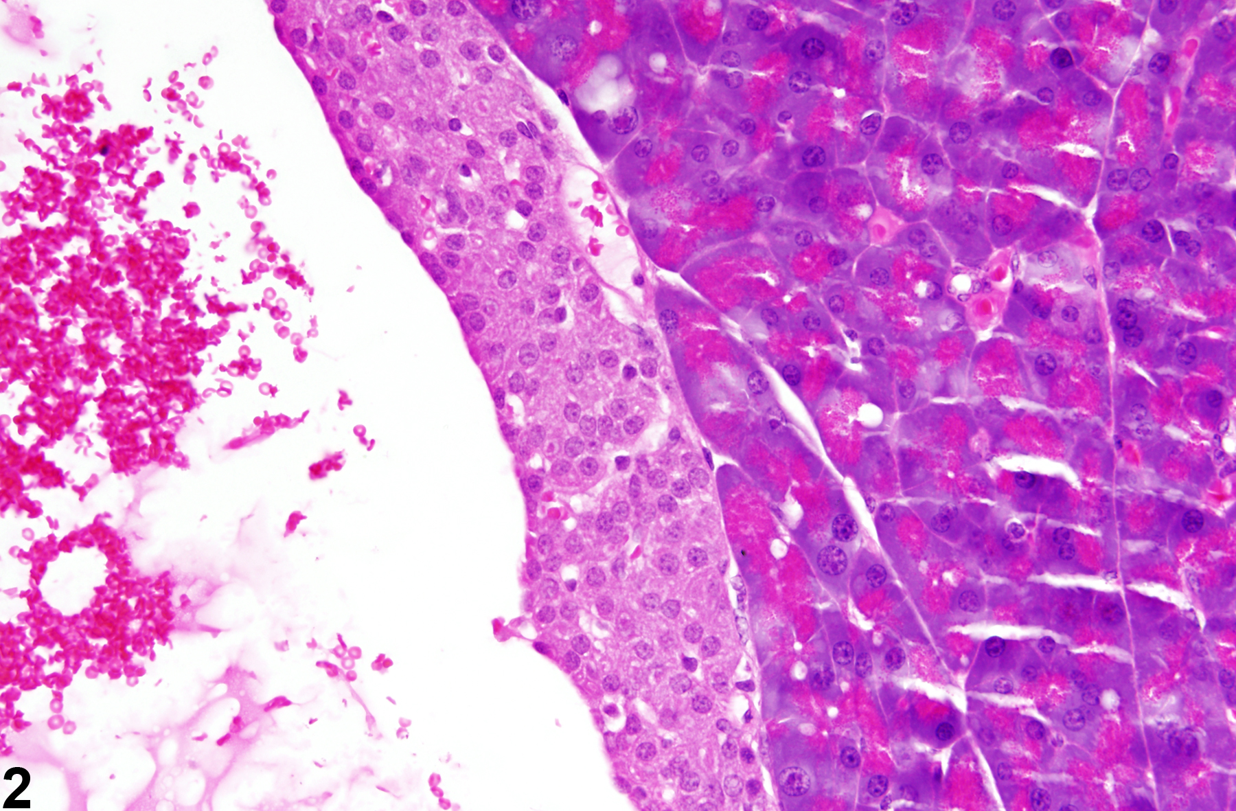 Image of cyst in the pancreatic islet from a male B6C3F1 mouse in a chronic study