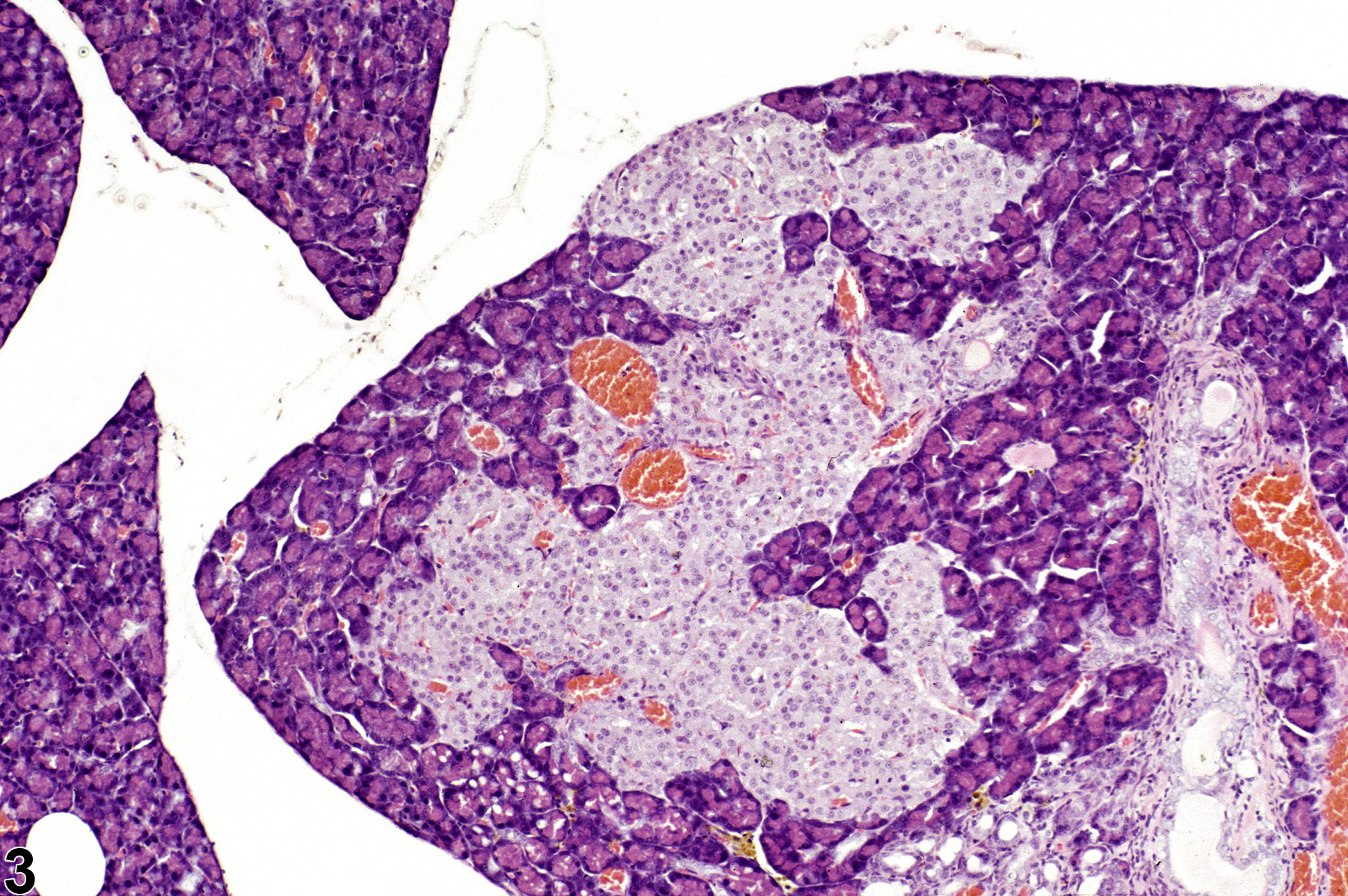 Image of hyperplasia in the pancreatic islet from a male B6C3F1 mouse in a chronic study