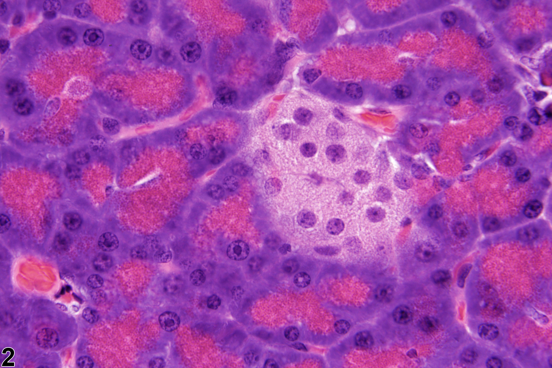 Image of hypoplasia in the pancreatic islet from a female F344/N rat in a chronic study