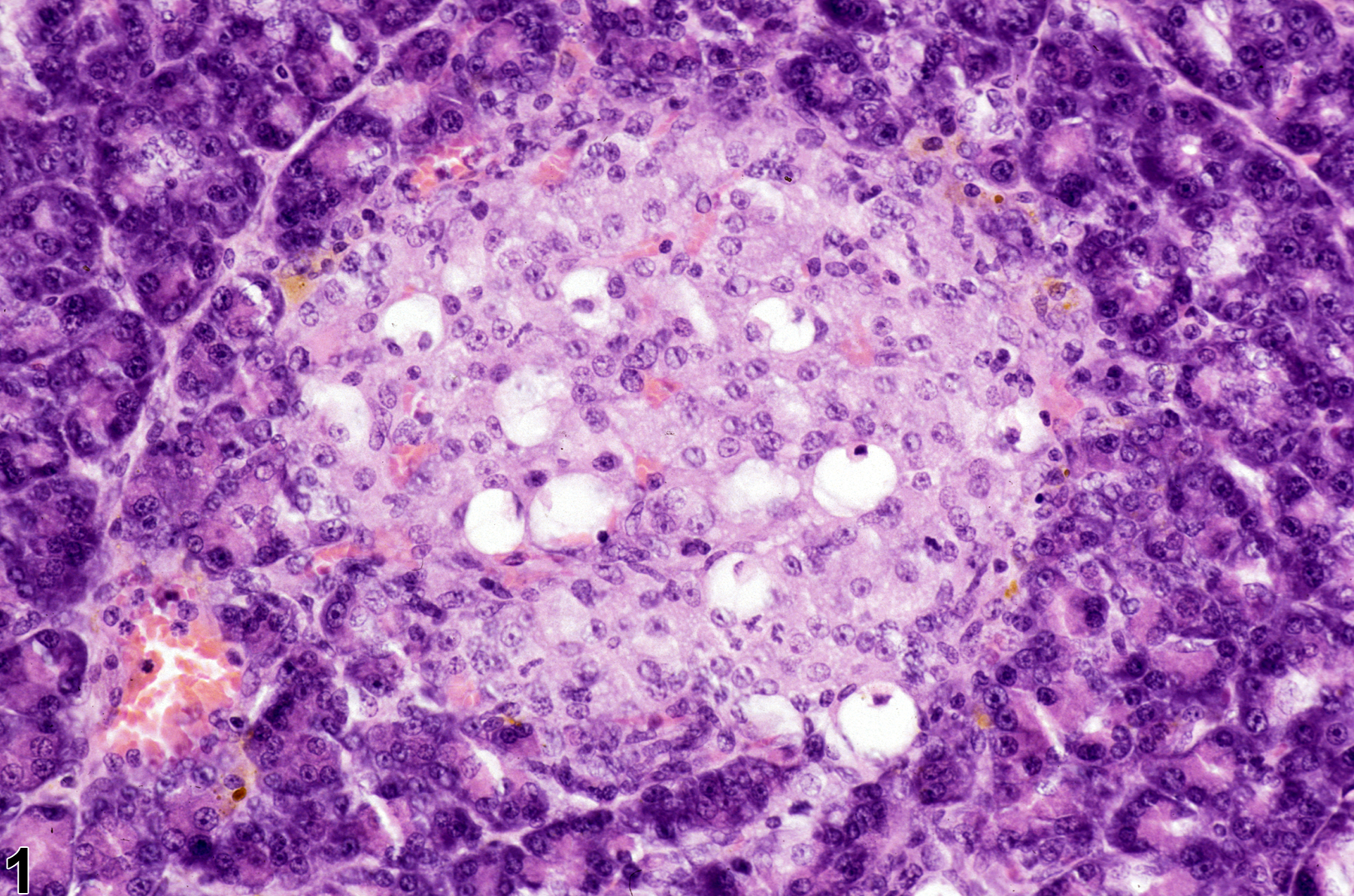 Image of necrosis in the pancreatic islet from a female F344/N rat in a chronic study