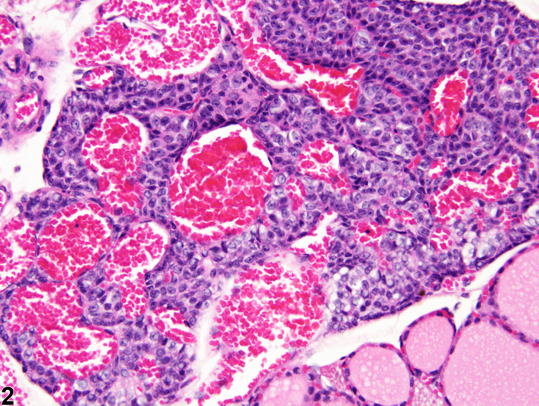 Image of angiectasis in the parathyroid gland from a male BALB/c mouse in a subchronic study