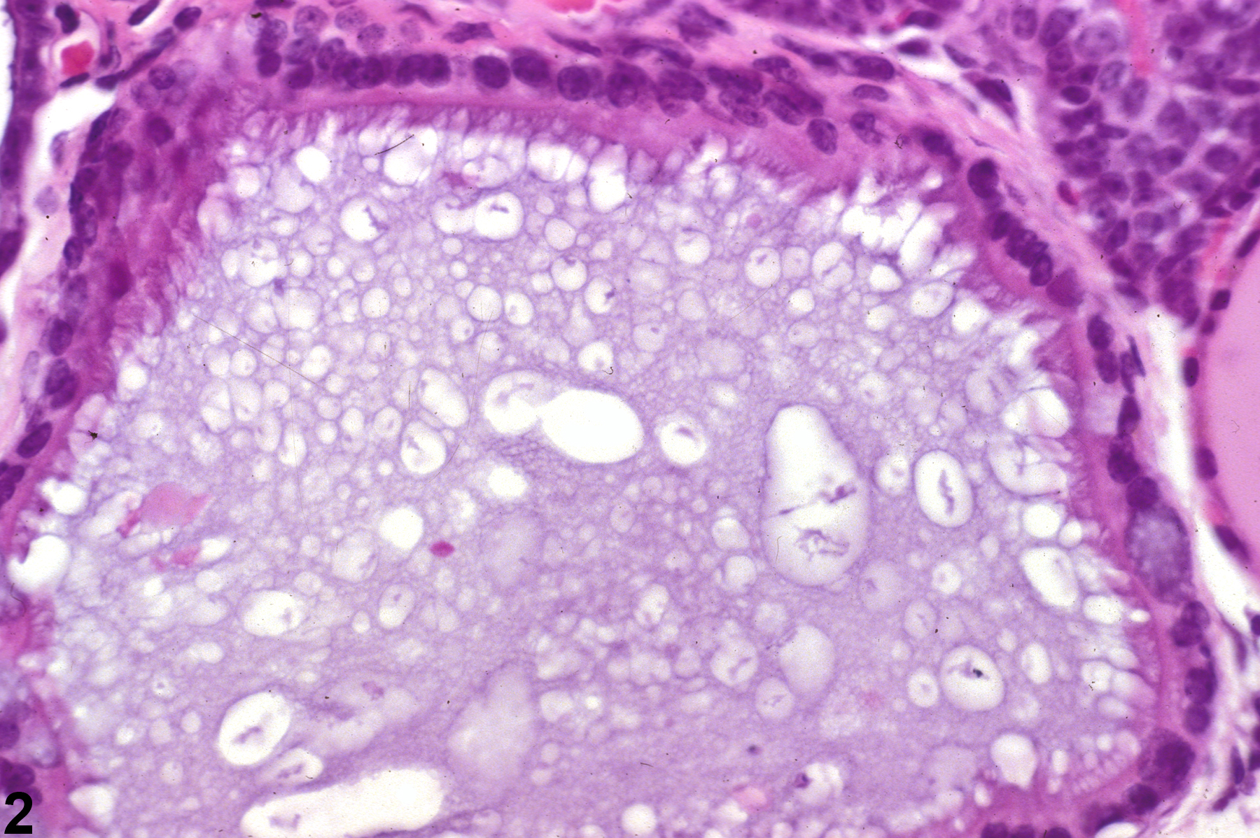 Image of cyst, congenital in the parathyroid gland from a male B6C3F1 mouse in a chronic study