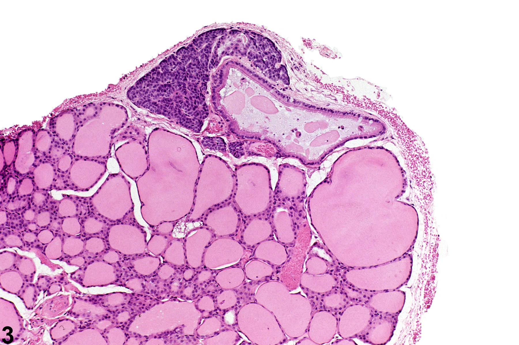 Image of cyst, congenital in the parathyroid gland from a male B6C3F1 mouse in a chronic study