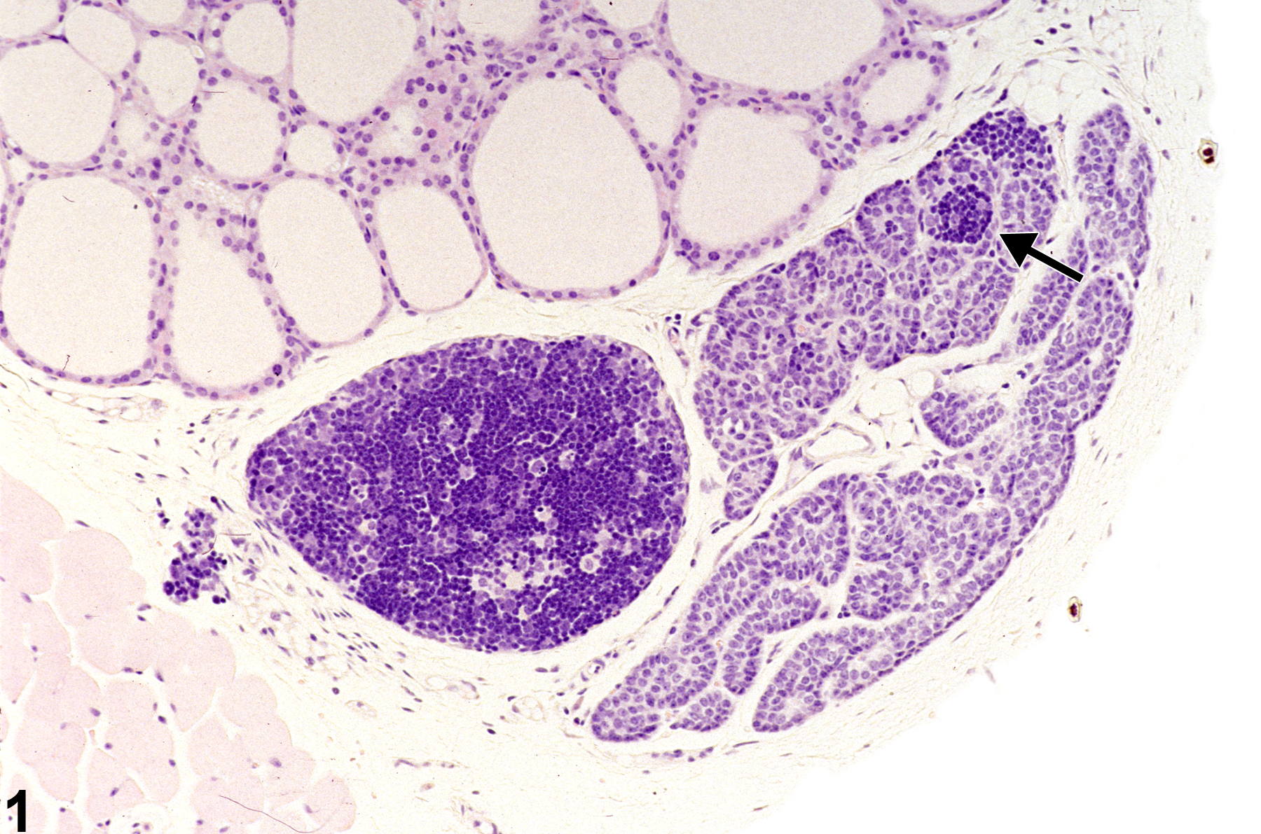 Image of ectopic tissue in the parathyroid gland from a female B6C3F1 mouse in a subchronic study