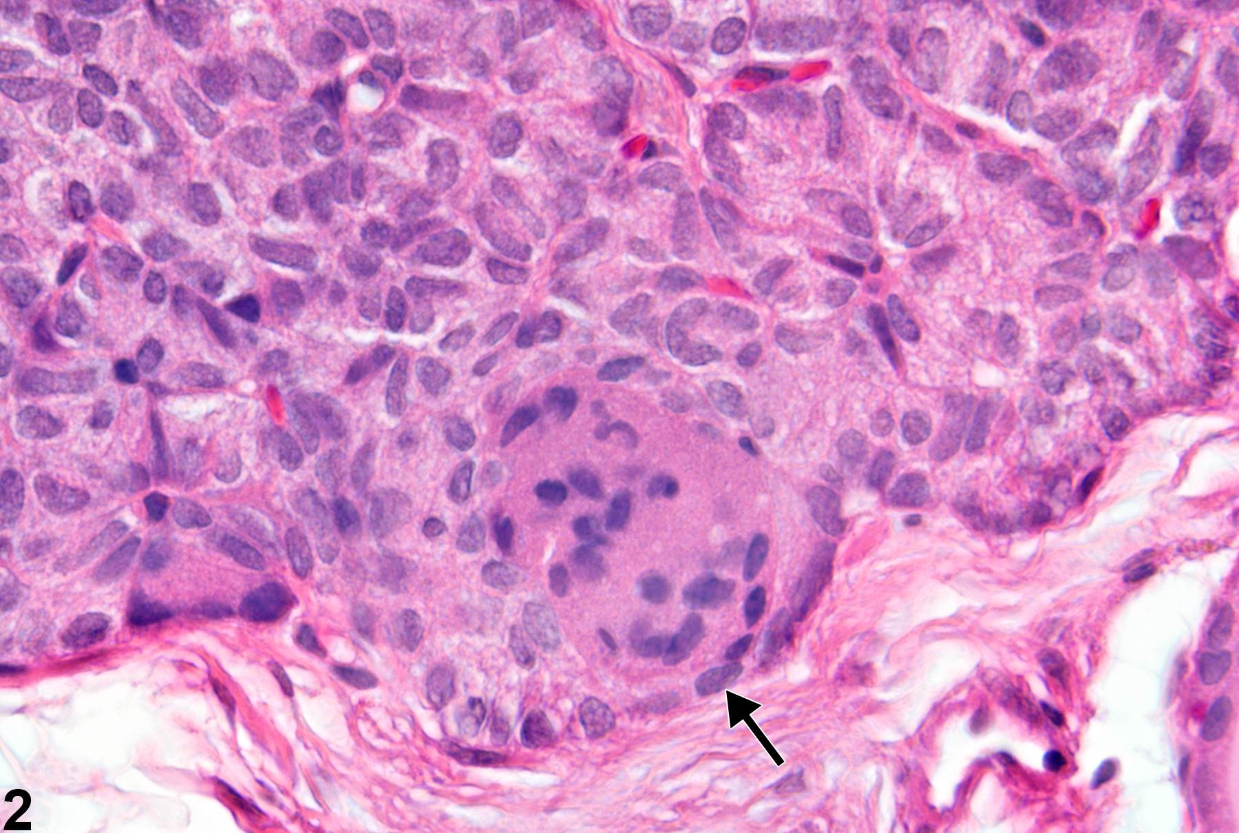 Image of syncytial giant cell in the parathyroid gland from a male F344/N rat in a subchronic study