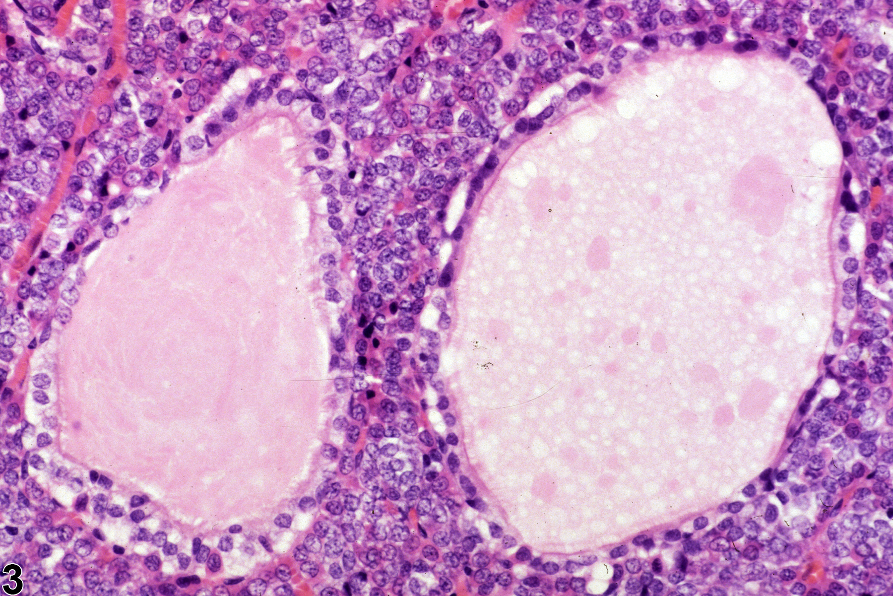 Image of cyst in the pituitary gland from a male F344/N rat in a chronic study