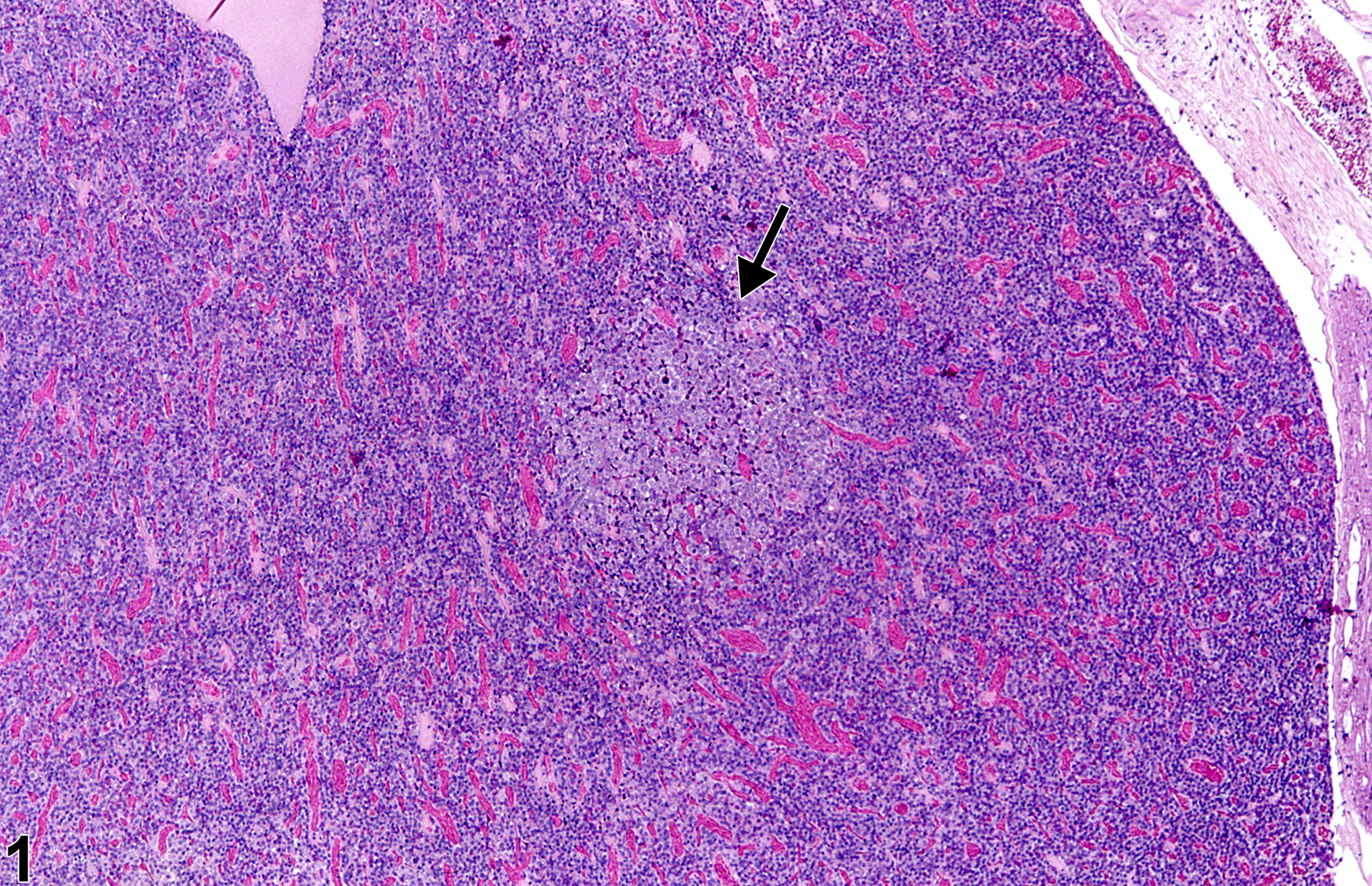 Image of hyperplasia in the pituitary gland from a female Harlan Sprague-Dawley rat in a chronic study