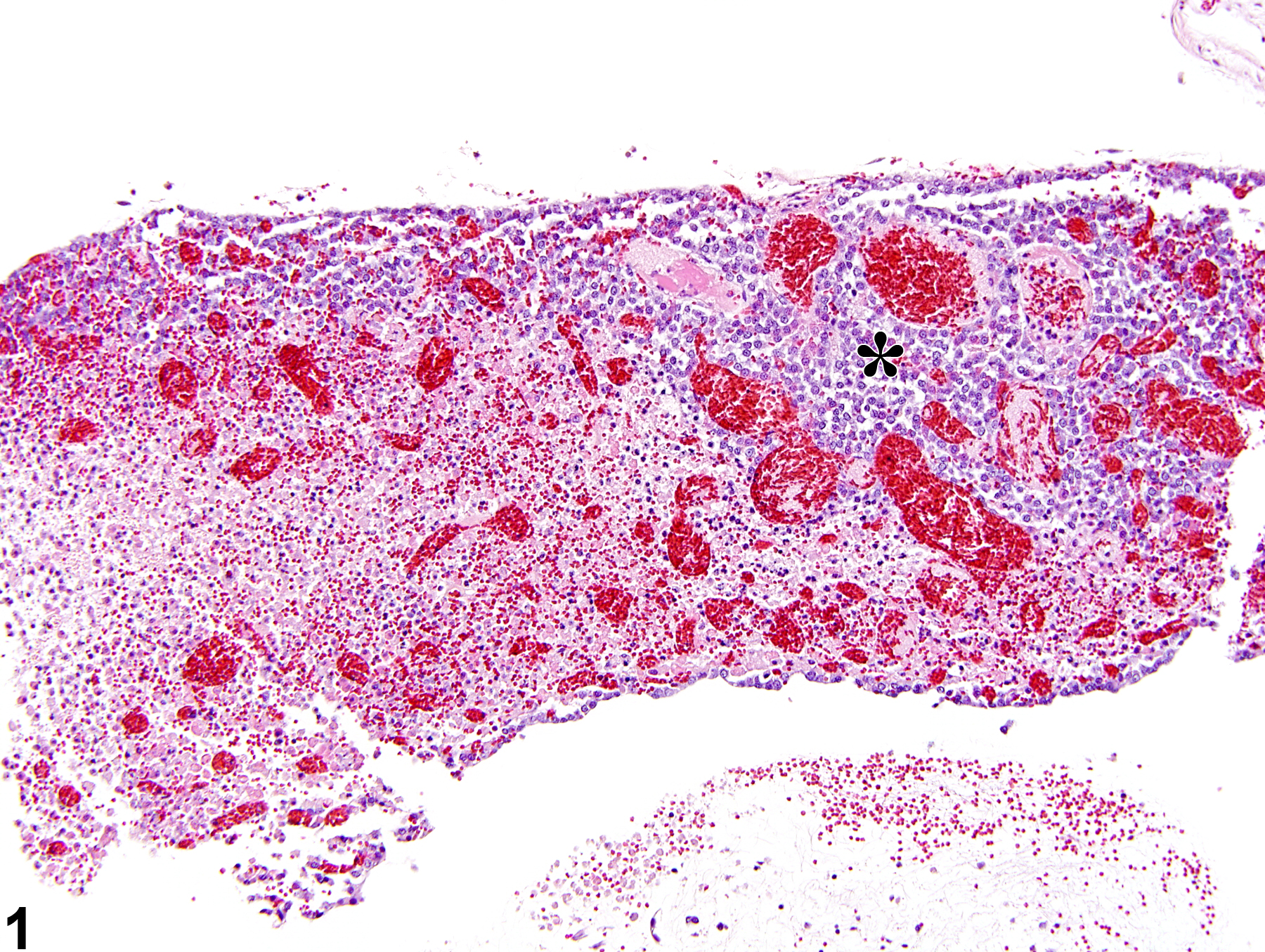 Image of pars distalis necrosis in the pituitary gland from a female F344/N rat in a subchronic study