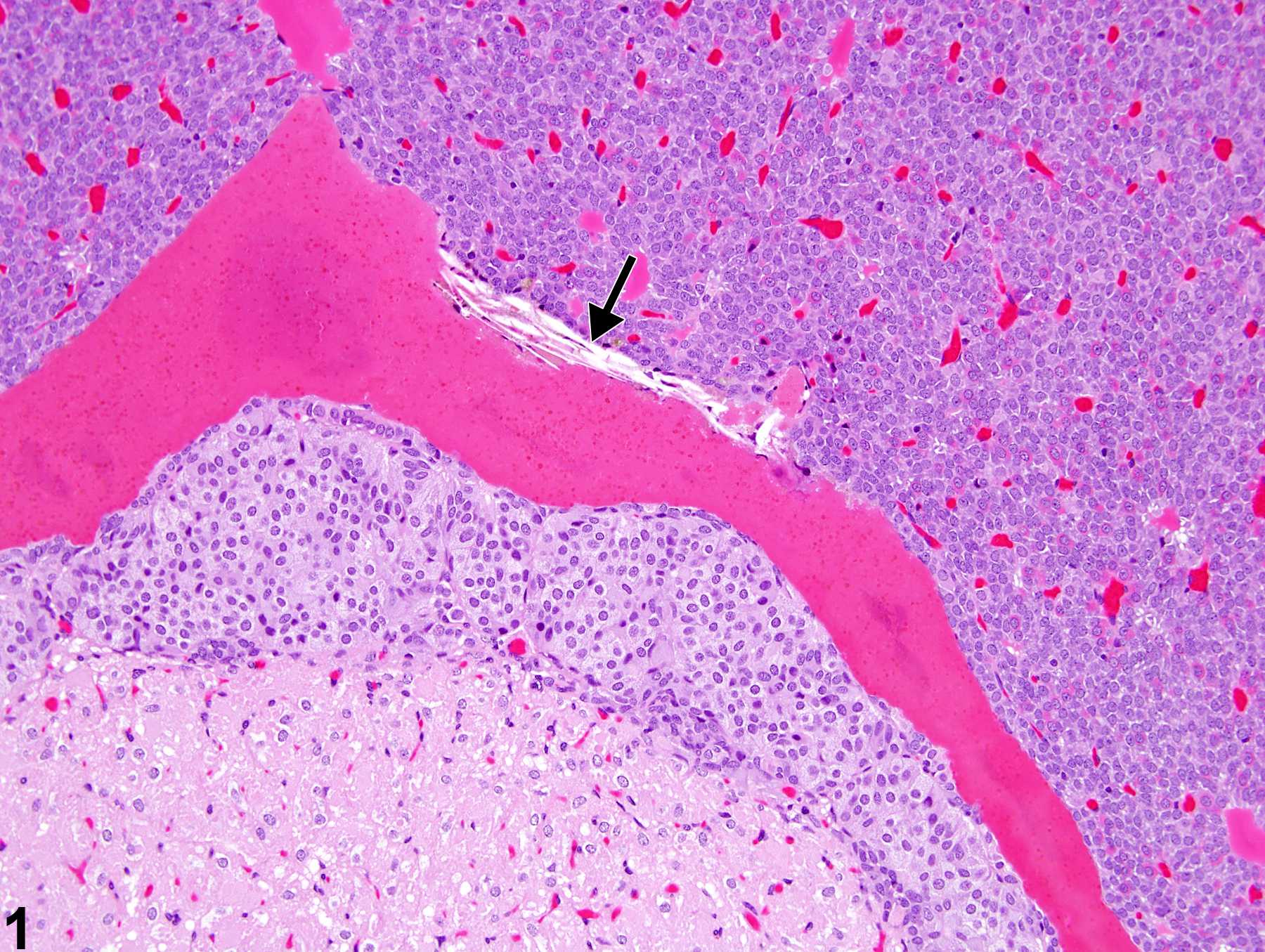 Image of Rathke's cleft dilation in the pituitary gland from a female F344/N rat in a chronic study