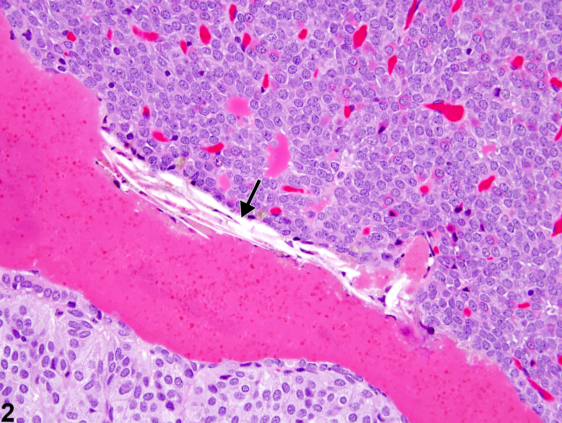 Image of Rathke's cleft dilation in the pituitary gland from a female F344/N rat in a chronic study