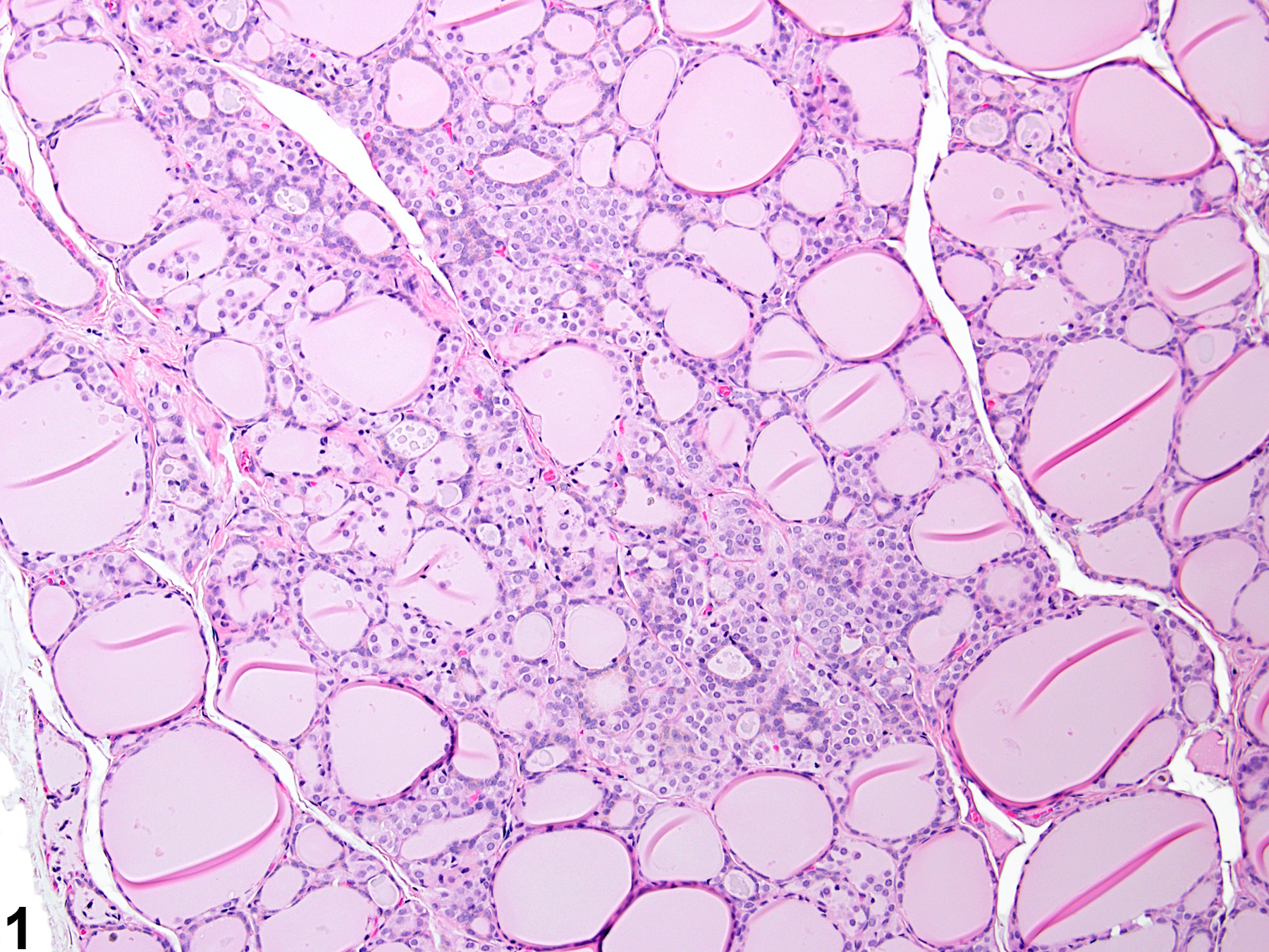 Image of C cell hyperplasia in the thyroid gland from a female F344/N rat in a chronic study