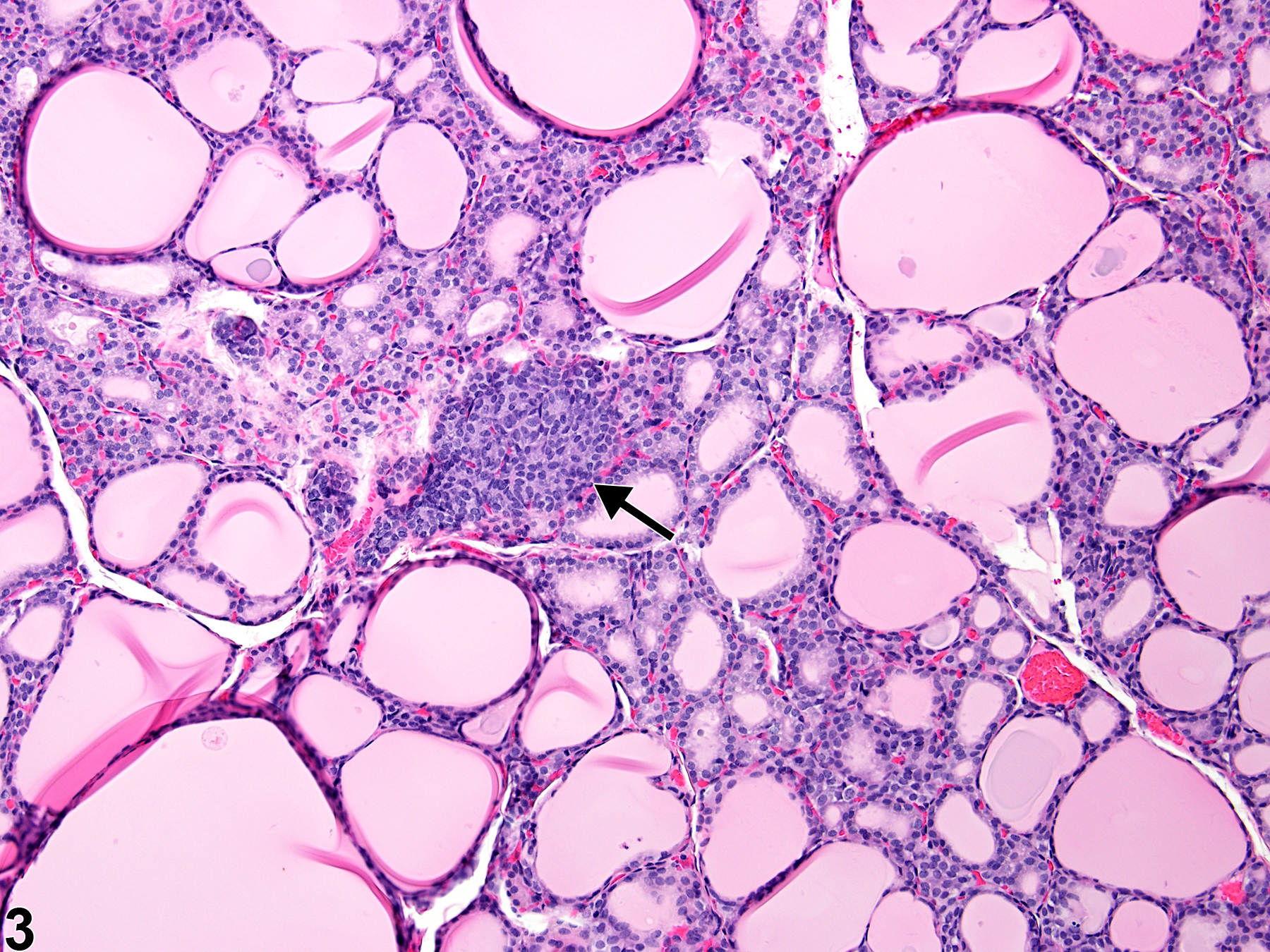 Image of C cell hyperplasia in the thyroid gland from a male F344/N rat in a chronic study