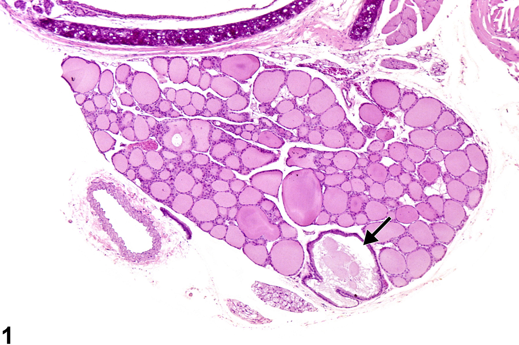 Image of cyst, congenital in the thyroid gland from a female F344/N rat in a chronic study