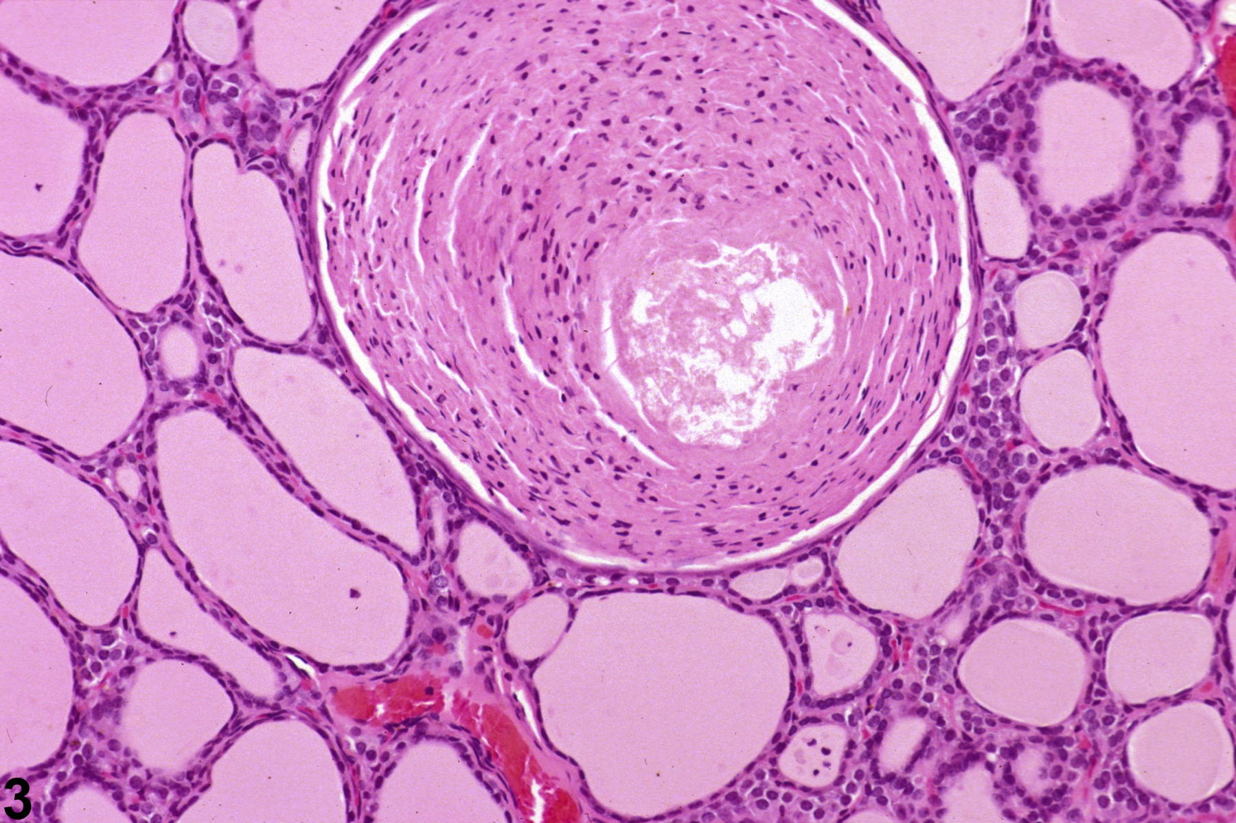 Image of cyst, congenital in the thyroid gland from a male B6C3F1 mouse in a chronic study