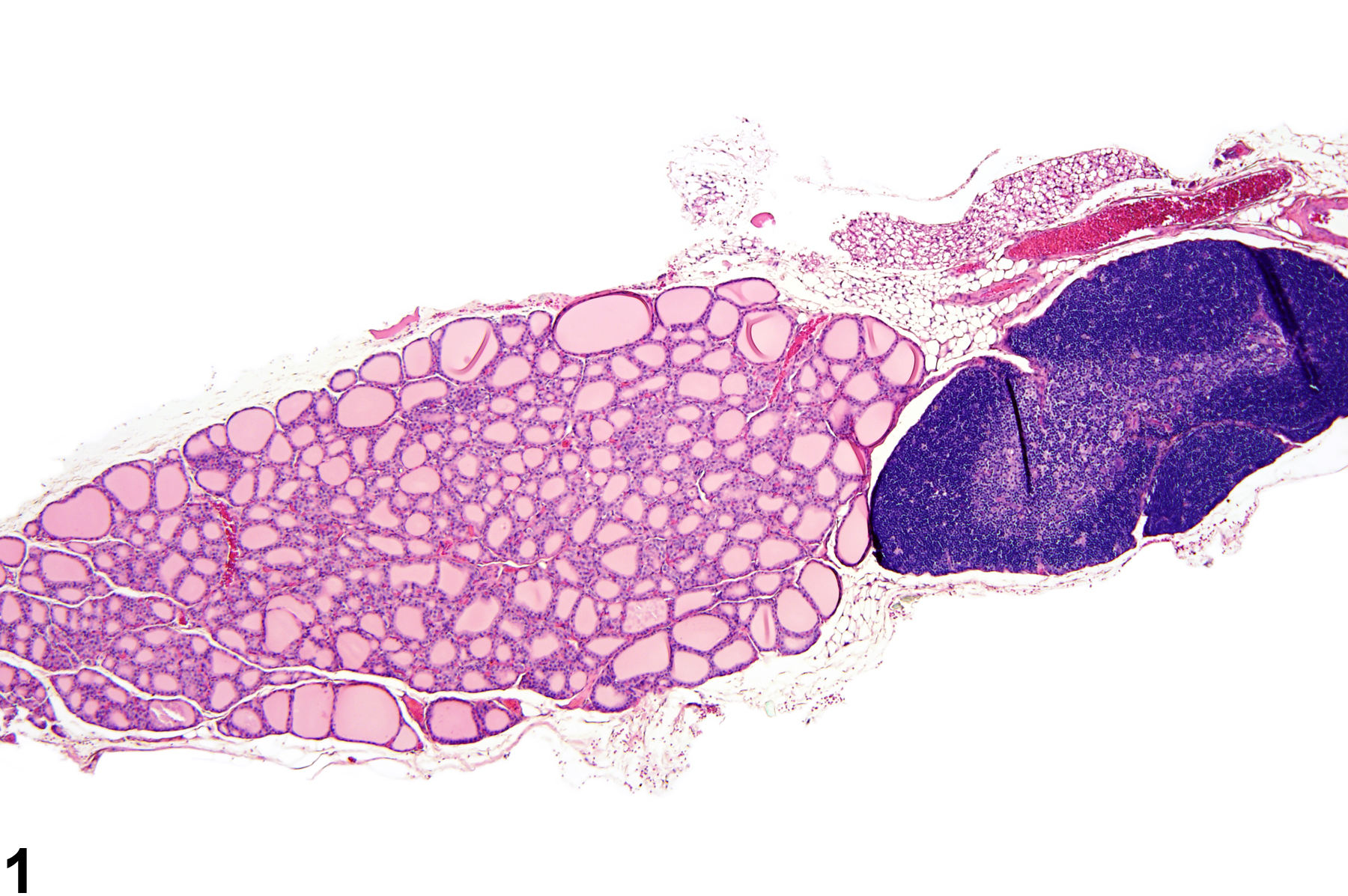 Image of ectopic tissue in the thyroid gland from a female F344/N rat in a subchronic study