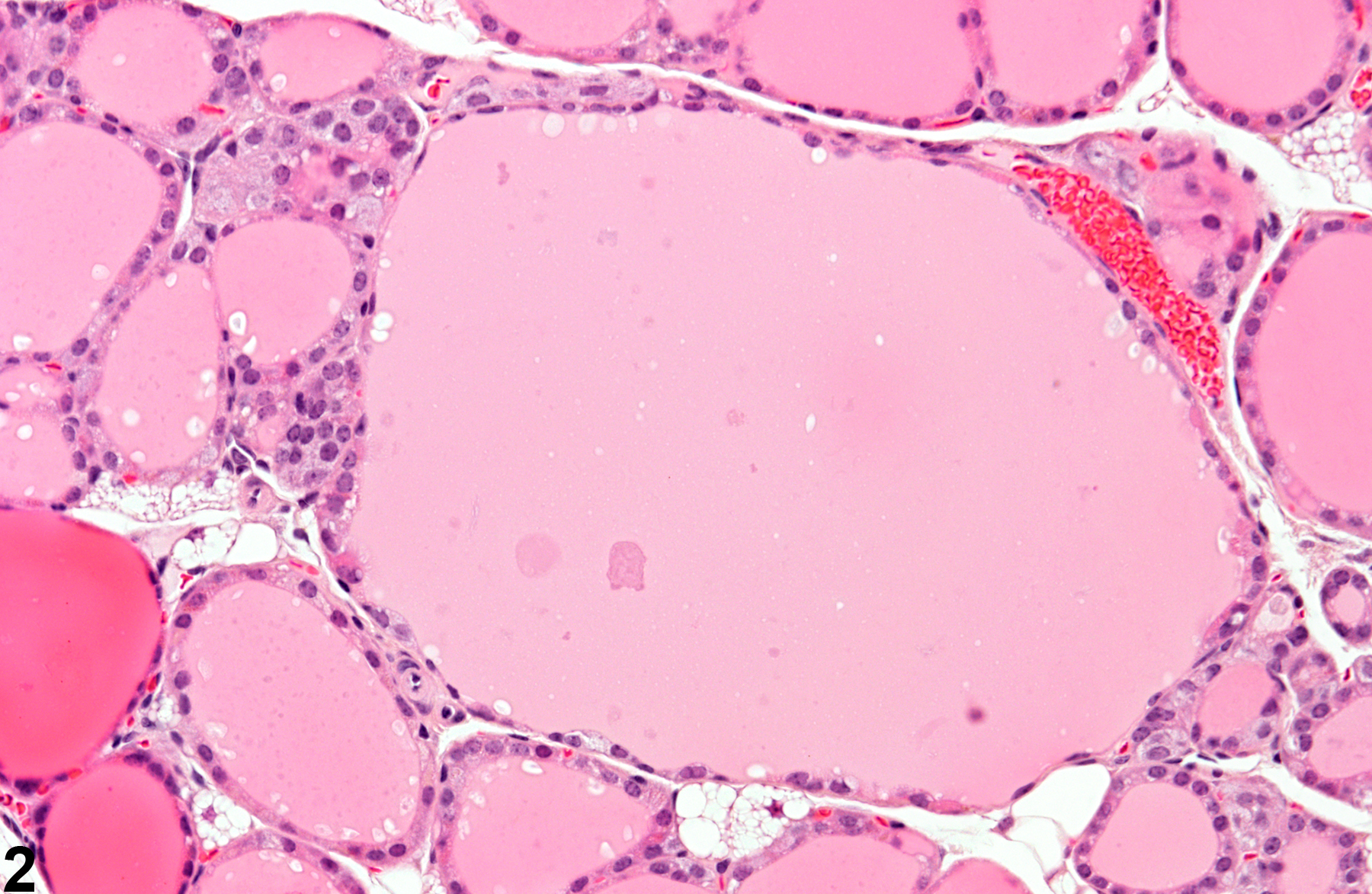 Image of follicle dilation in the thyroid gland from a male B6C3F1 mouse in a chronic study