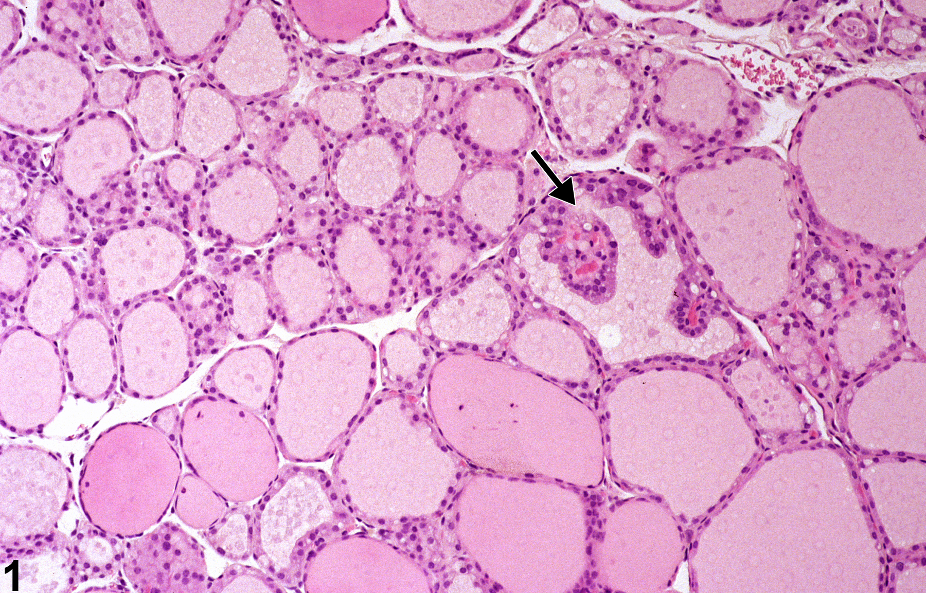 Image of follicle epithelium hyperplasia in the thyroid gland from a male B6C3F1 mouse in a chronic study