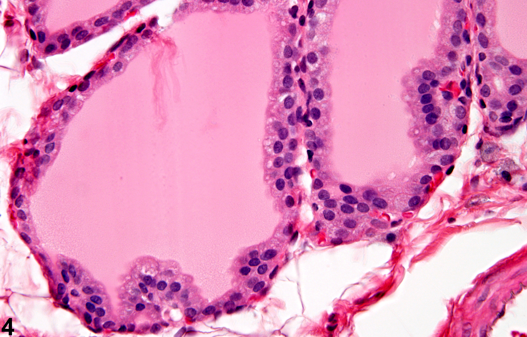 Image of follicle epithelium hyperplasia in the thyroid gland from a male F344/N rat in a subchronic study