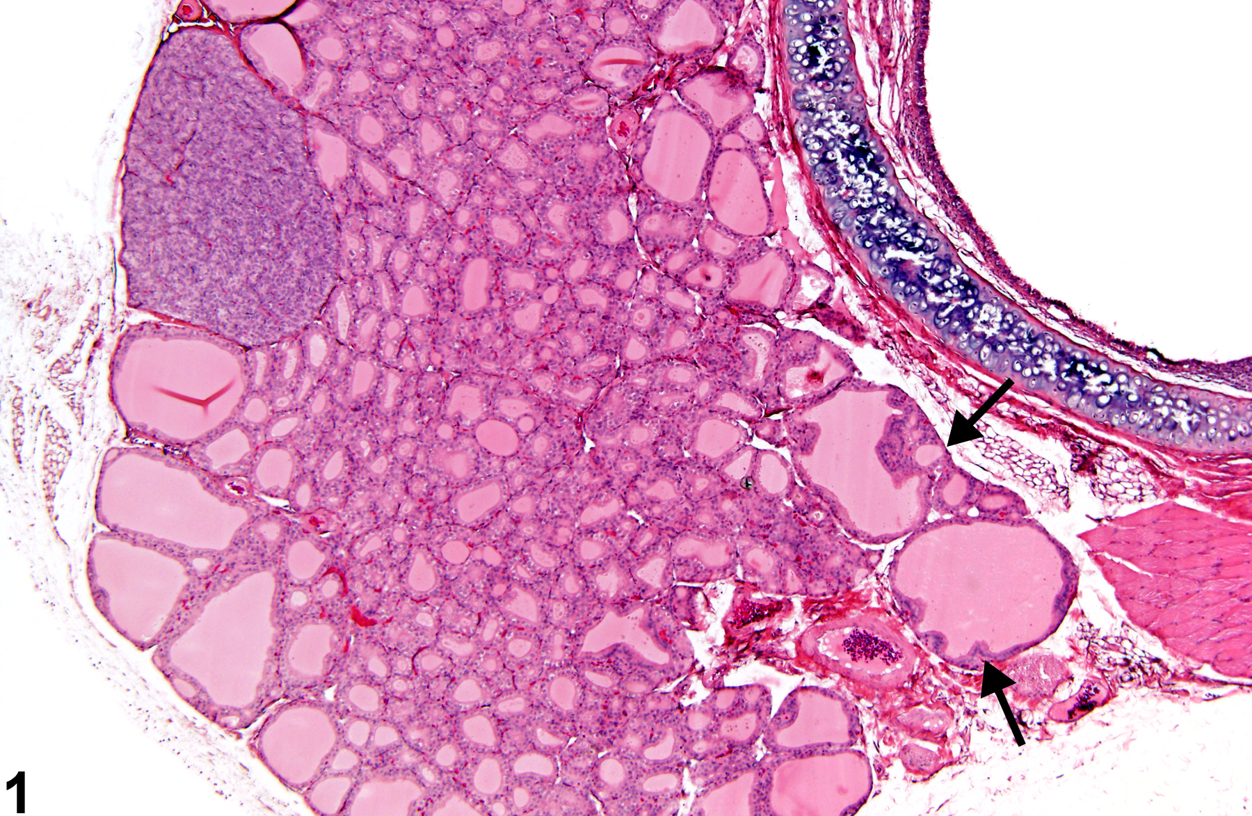 Image of follicular cell hypertrophy in the thyroid gland from a male F344/N rat in a subchronic study