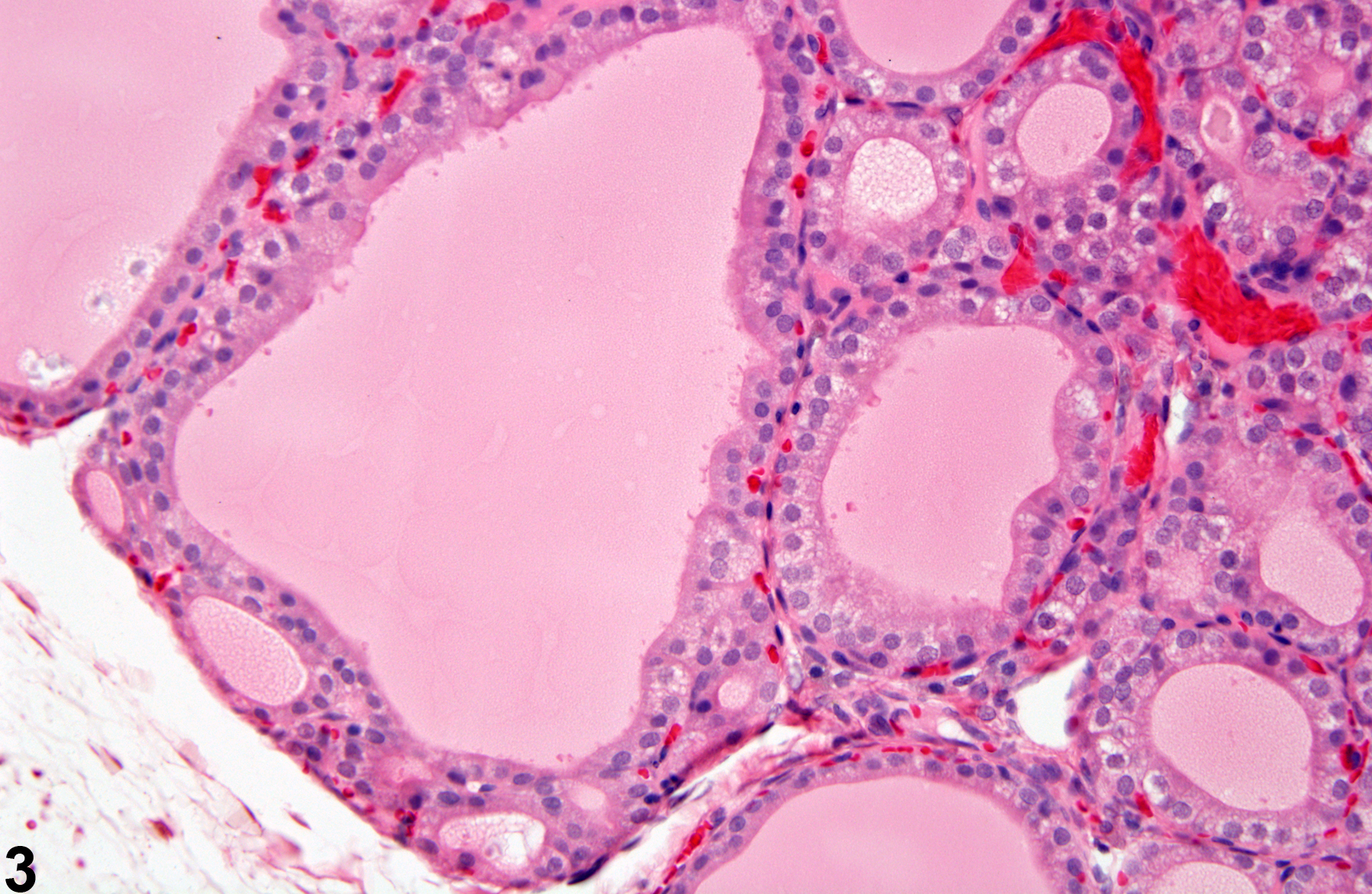 Image of follicular cell hypertrophy in the thyroid gland from a male F344/N rat in a subchronic study