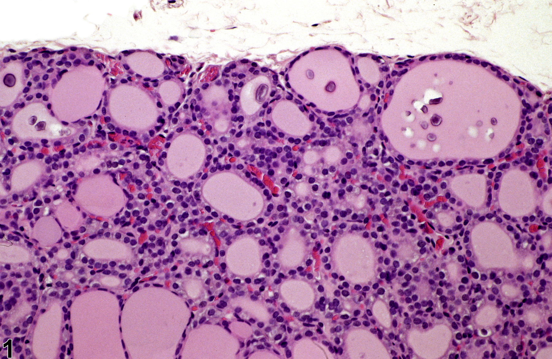 Image of follicle mineralization in the thyroid gland from a male F344/N rat in a chronic study