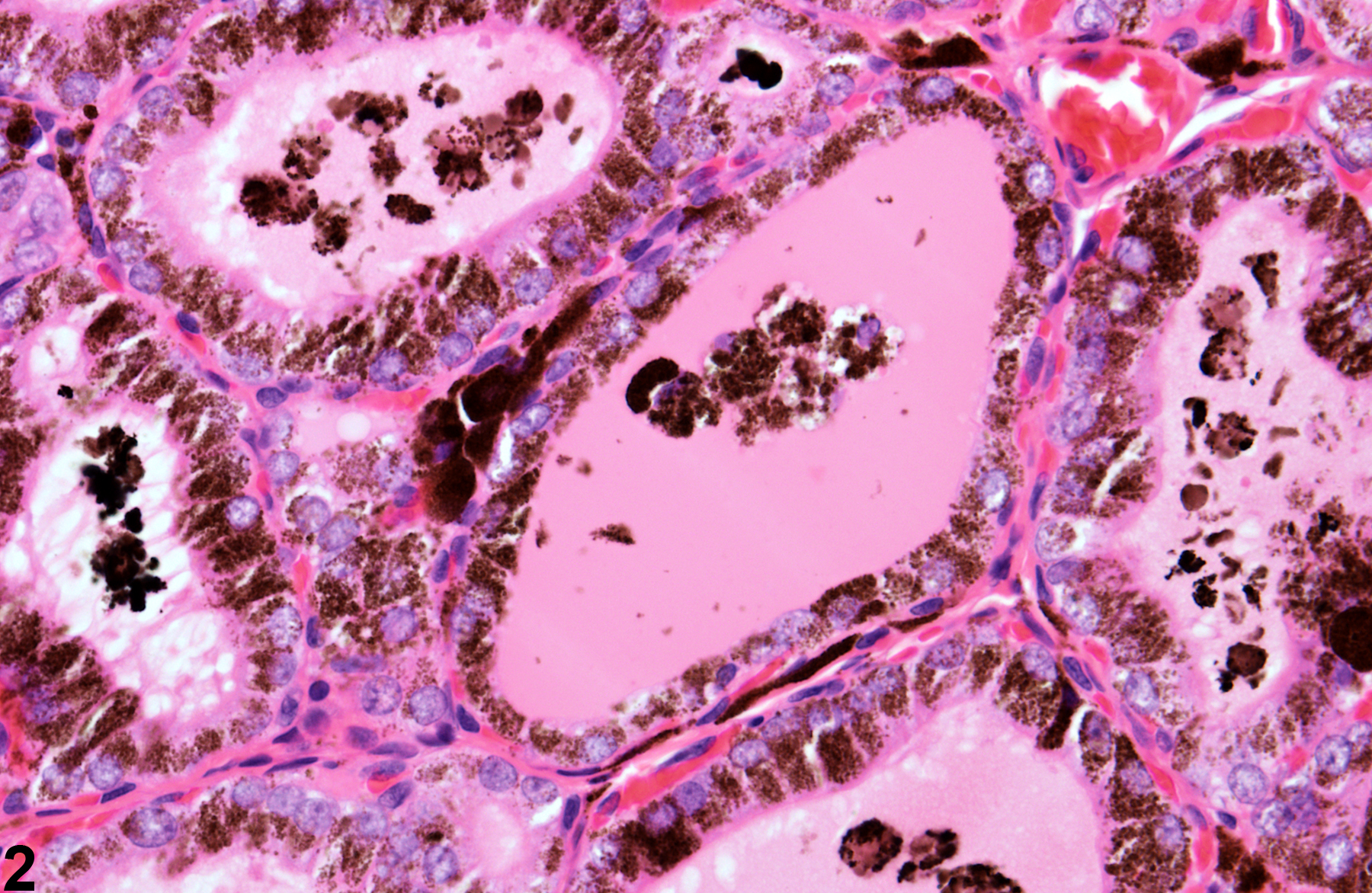 Image of follicle pigment in the thyroid gland from a male F344/N rat in a subchronic study