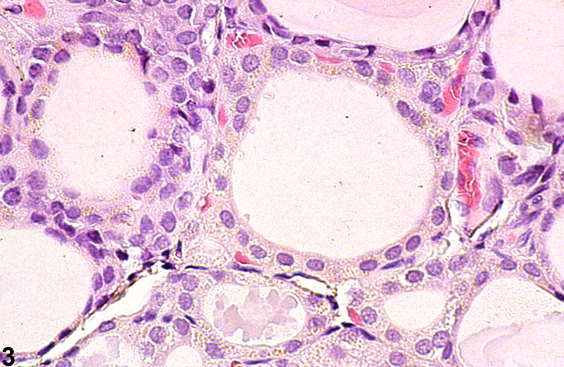 Image of follicle pigment in the thyroid gland from a male F344/N rat in a chronic study