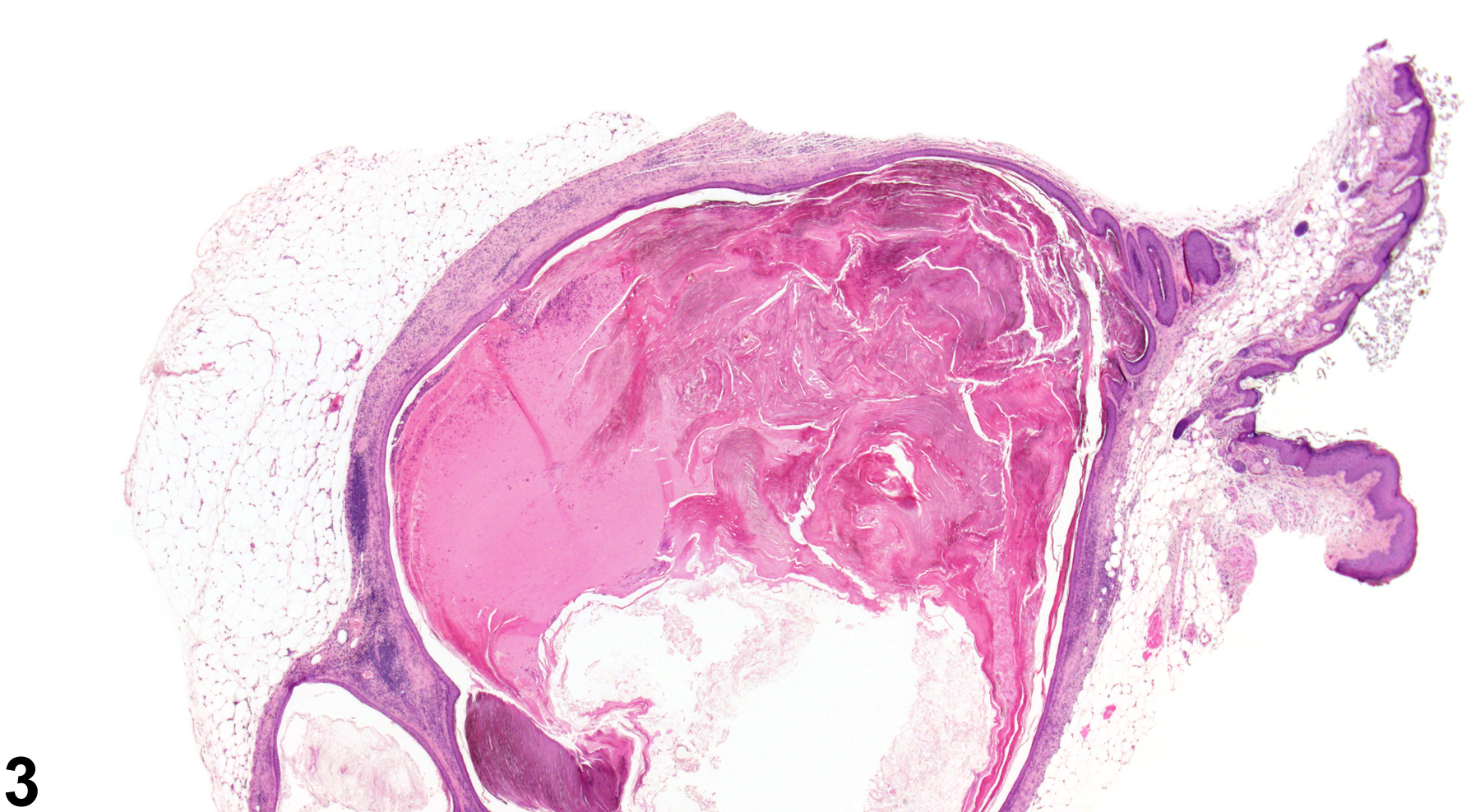 Image of duct dilation in the clitoral gland from a female B6C3F1 mouse in a chronic study