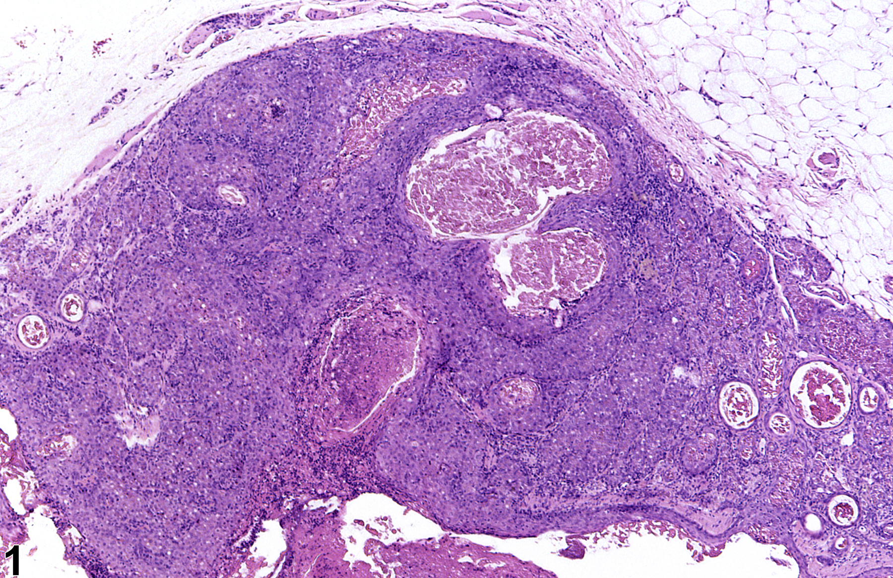 Image of hyperplasia in the clitoral gland from a female F344/N rat in a chronic study