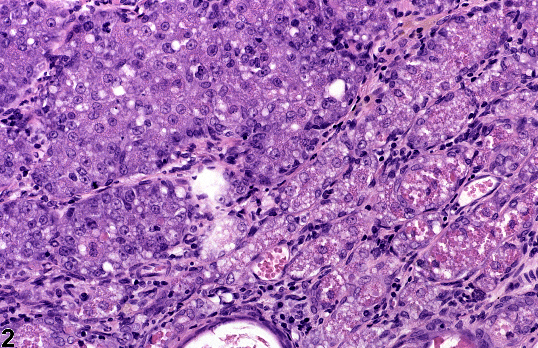 Image of hyperplasia in the clitoral gland from a female F344/N rat in a chronic study